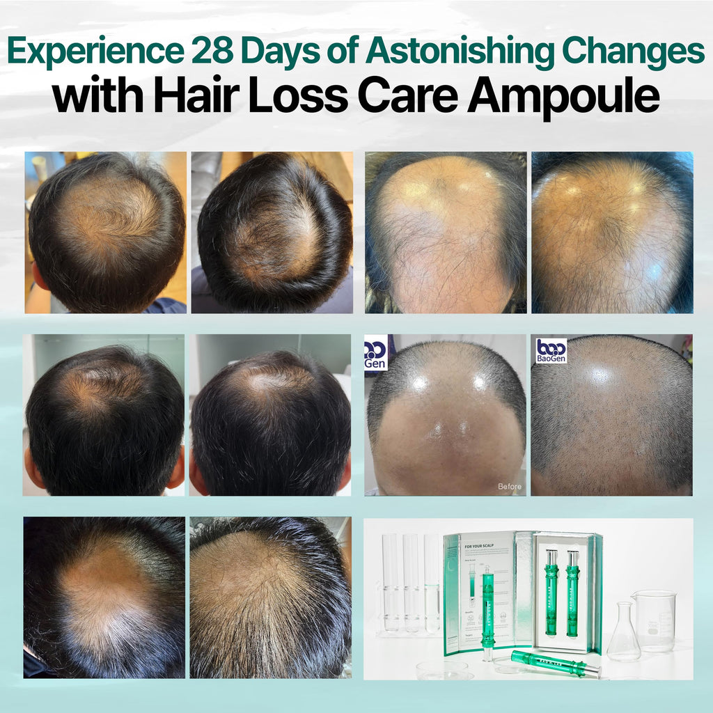 BAO_H.LAB Hair Loss Care Ampoule – CrediThink, 2 Ampoules, Non-Greasy