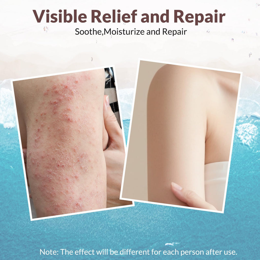 Crogooe Natural Soothing Eczema Cream – Sea Moss, Aloe Vera & Oats (4 oz)