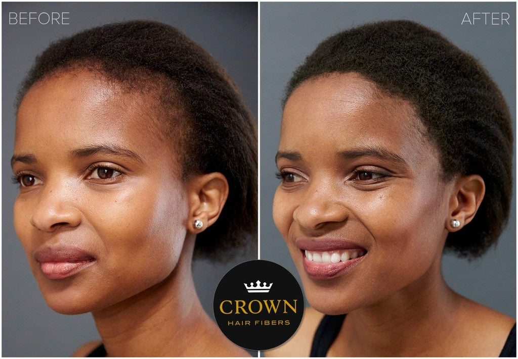 CROWN Hair Building Fibers (28g) – Instantly Conceal Thinning Hair with Keratin Fiber – 13 Shades for Men & Women – Light Brown