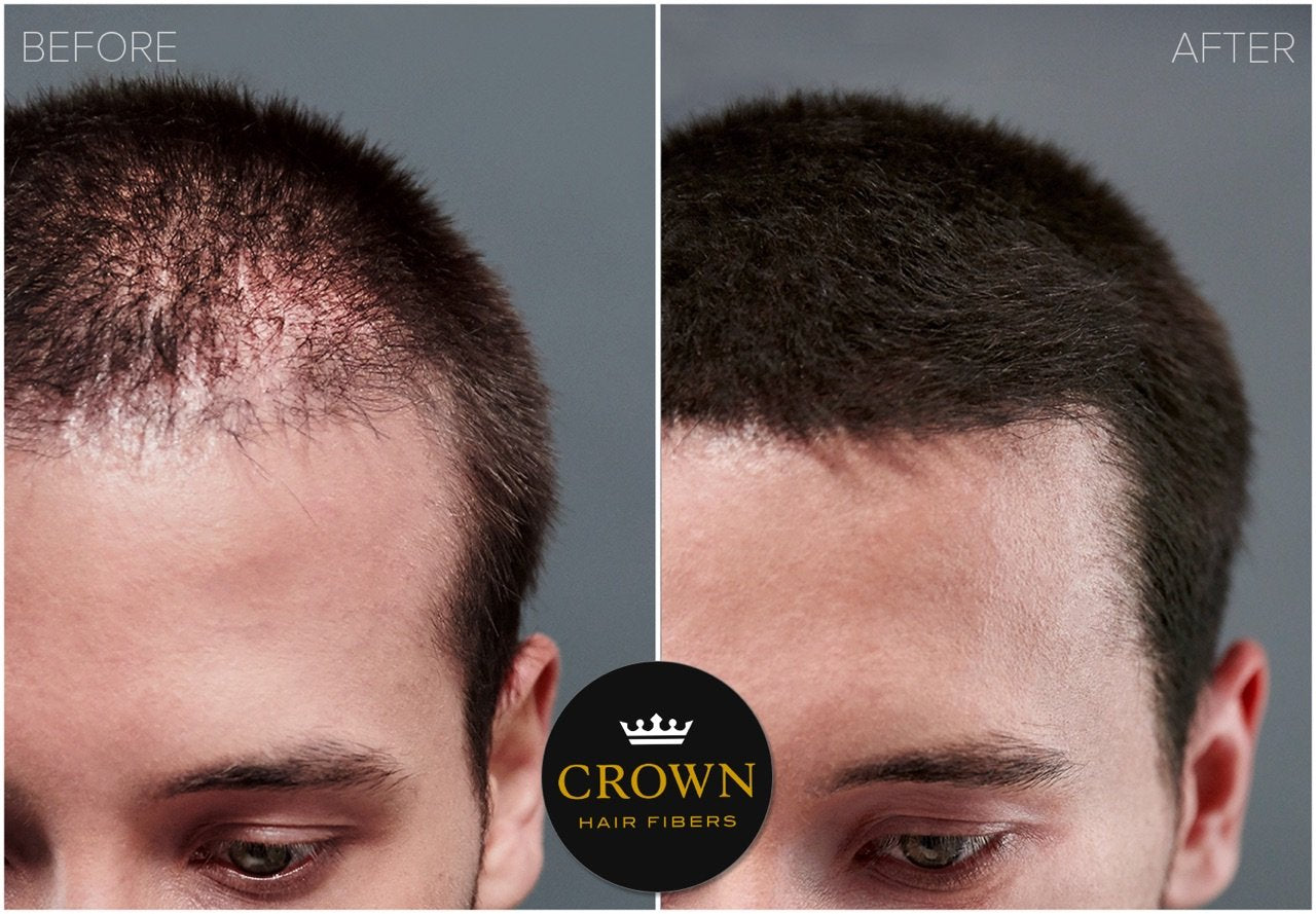 CROWN Hair Building Fibers (28g) – Instantly Conceal Thinning Hair with Keratin Fiber – 13 Shades for Men & Women – Light Brown
