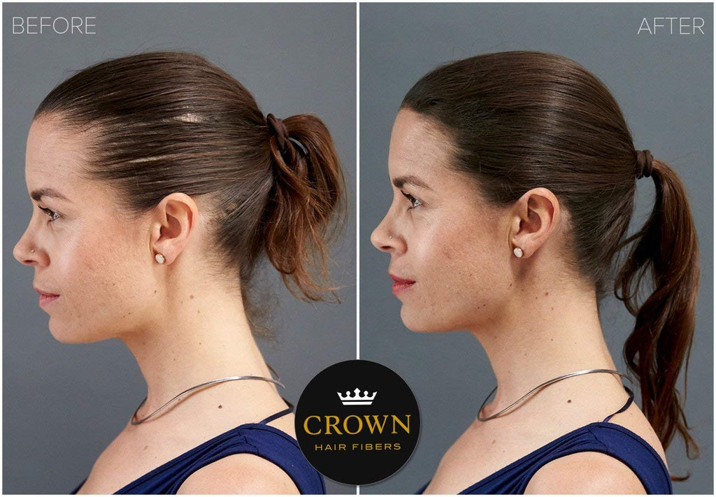 CROWN Hair Building Fibers (28g) – Instantly Conceal Thinning Hair with Keratin Fiber – 13 Shades for Men & Women – Light Brown