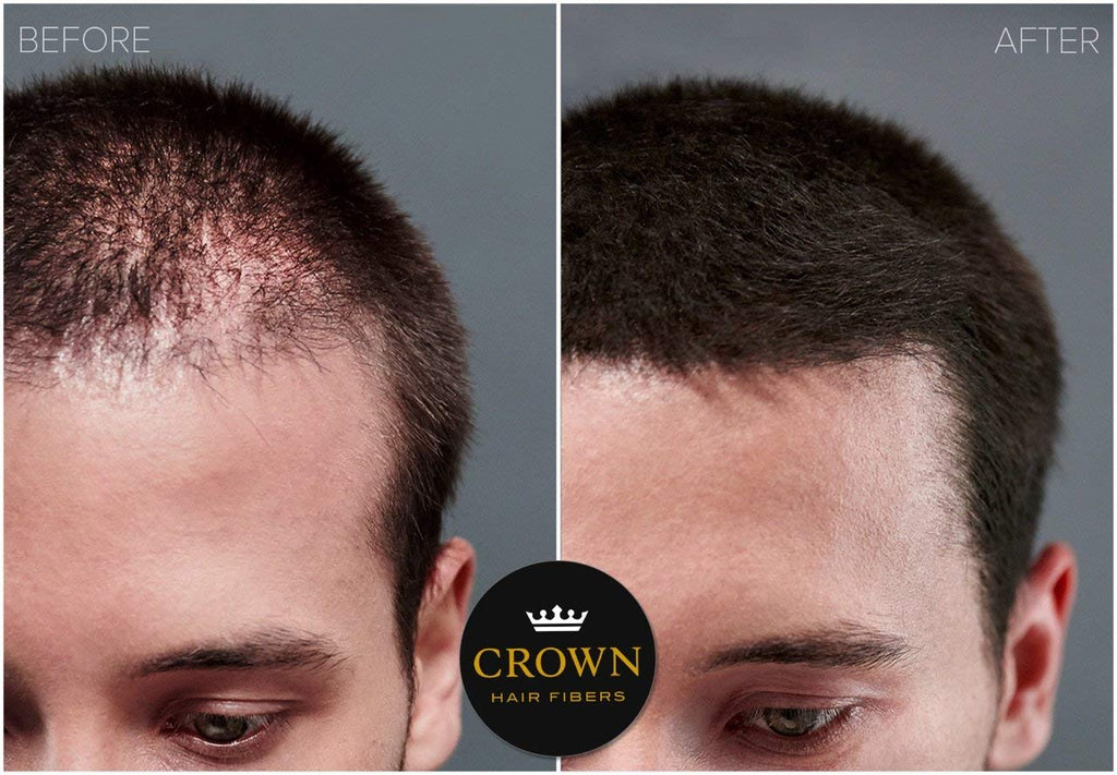 CROWN Hair Building Fibers (28g) – Instant Thinning Hair Concealment, 13 Shades