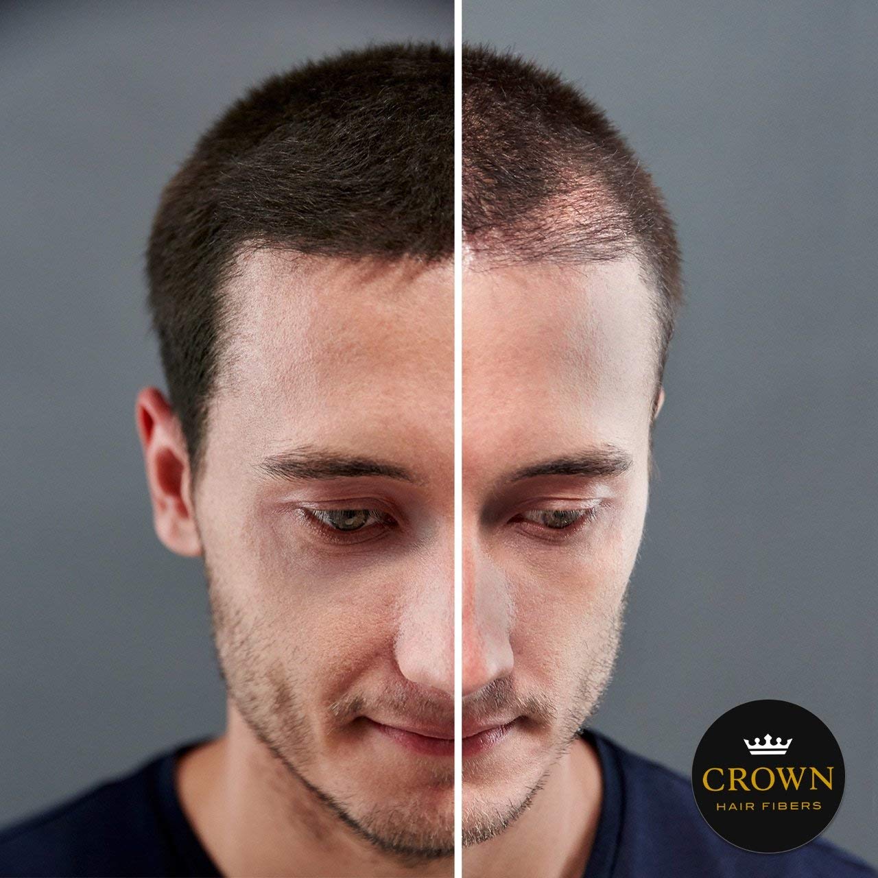CROWN Hair Building Fibers (28g) – Instantly Conceal Thinning Hair with Keratin Fiber – 13 Shades for Men & Women – Light Brown