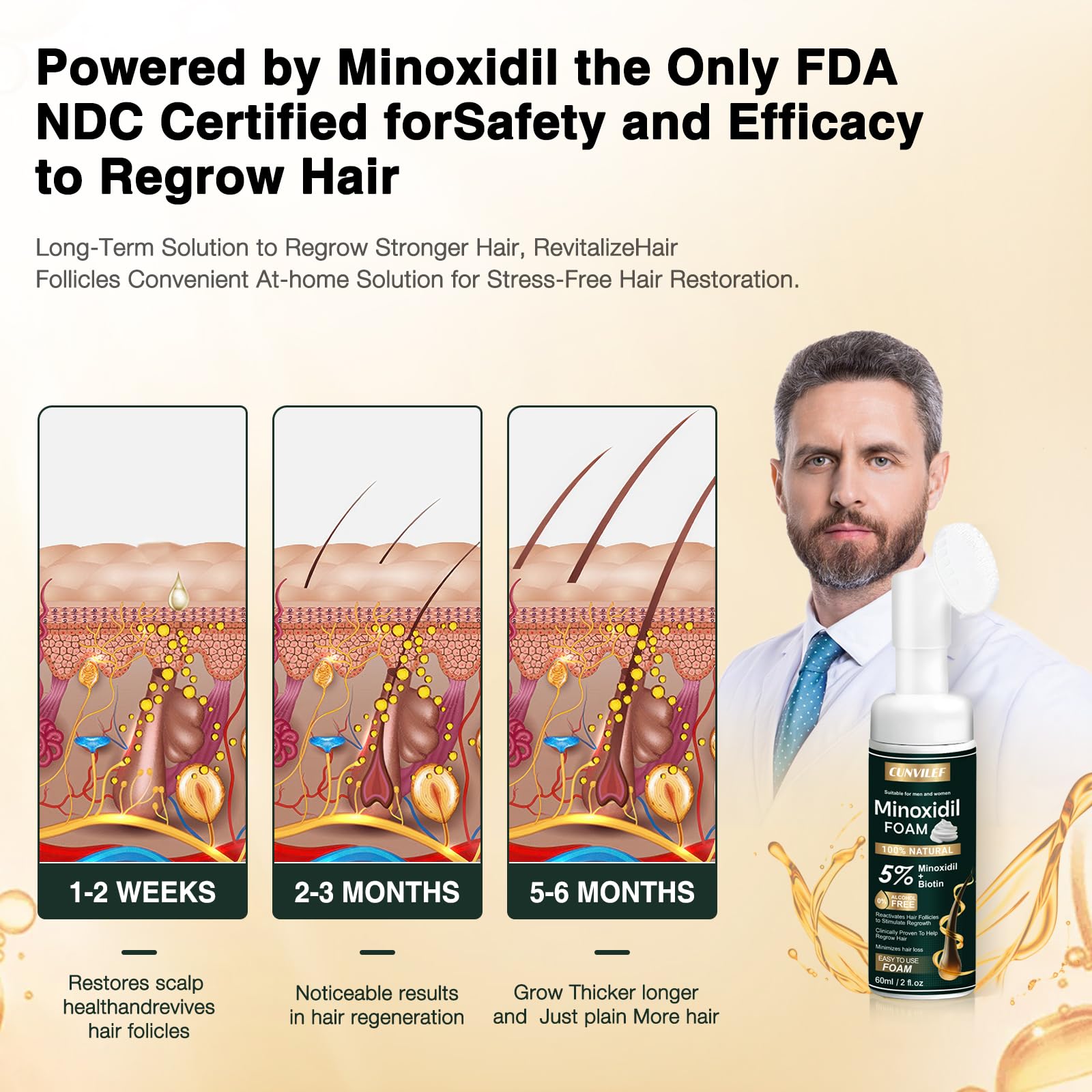 CUNVILEF 5% Minoxidil Foam for Men & Women – Hair Growth & Thicker Hair, 2.11 oz