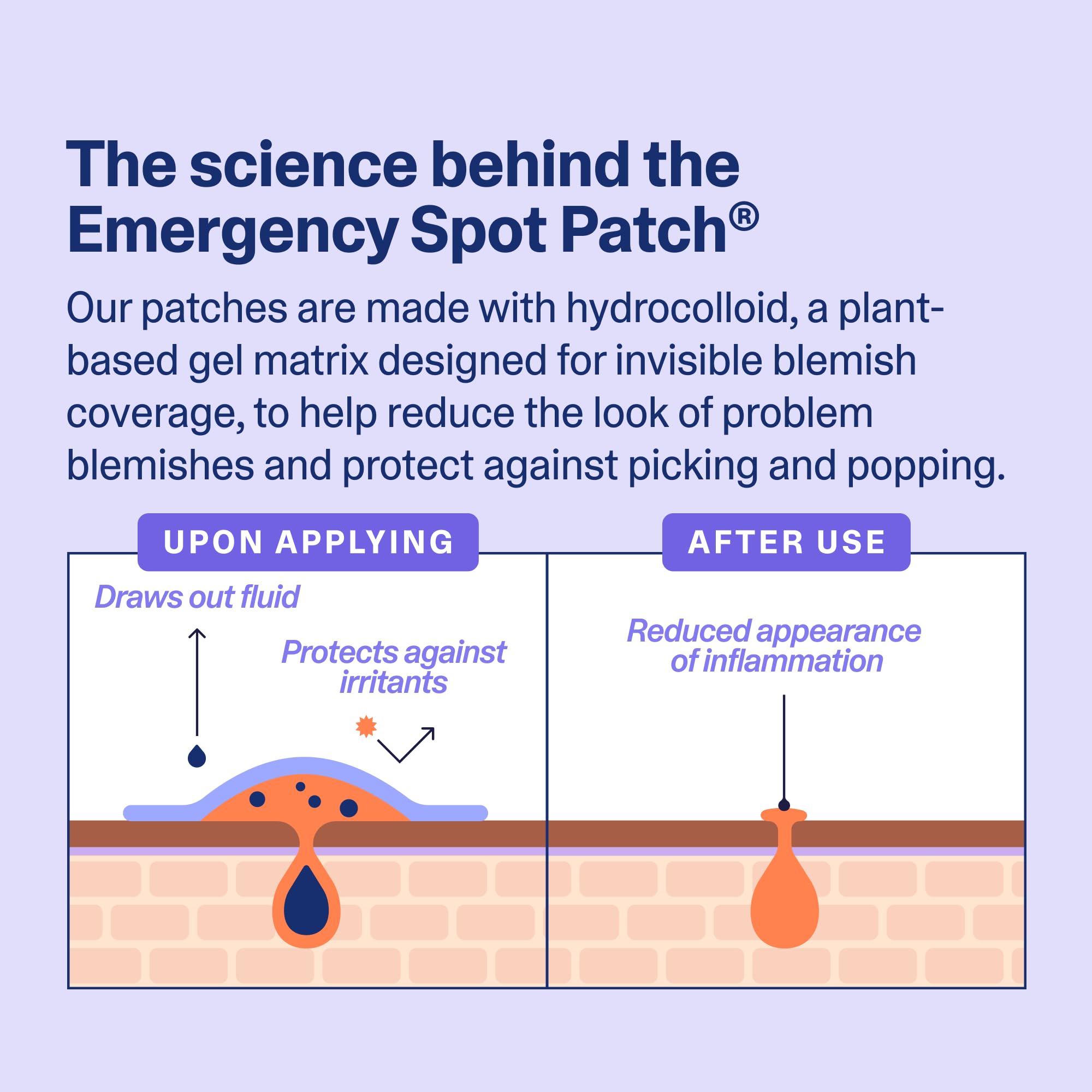 Curology Emergency Spot Patches for Face – Fast-Acting Hydrocolloid (80 Count)