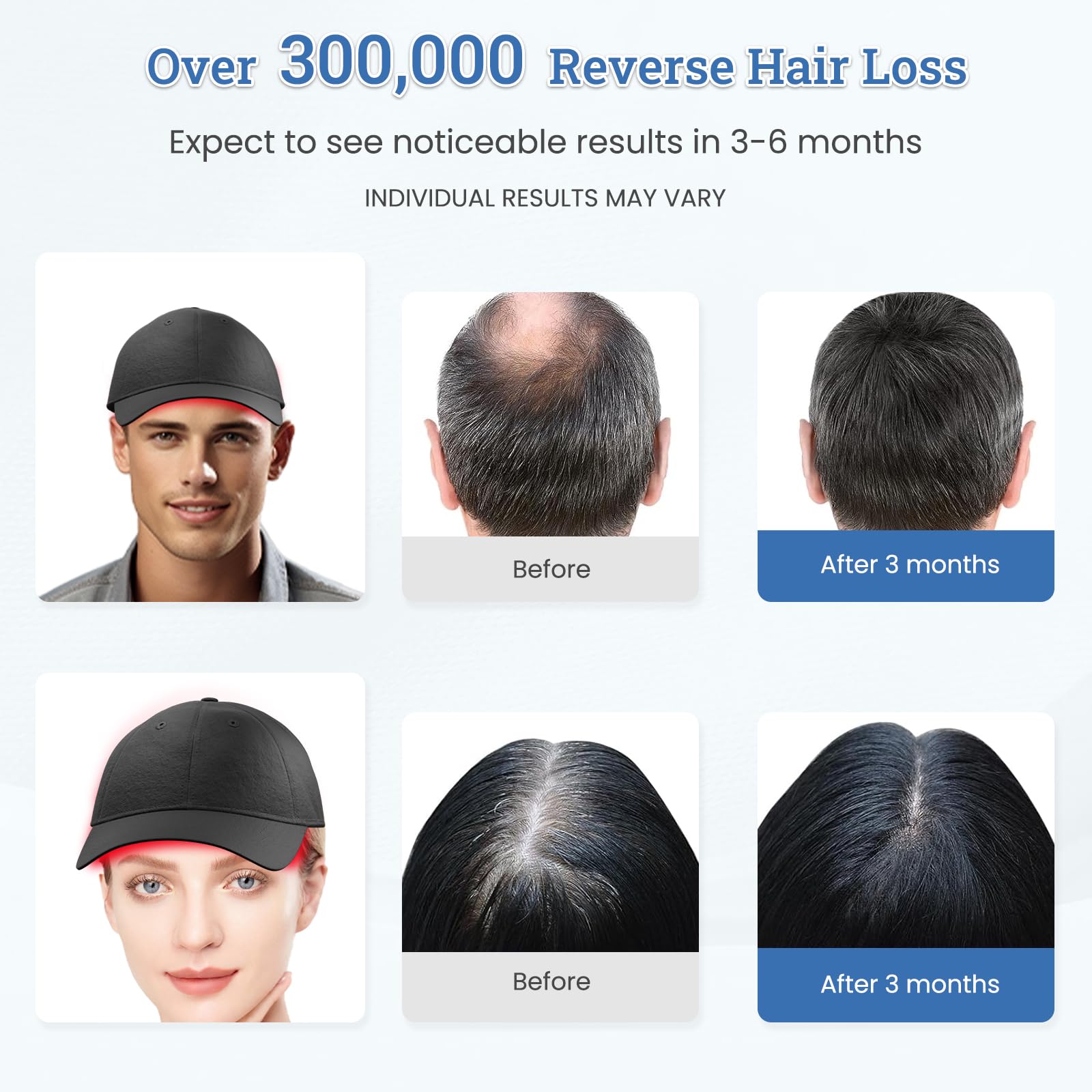 CWTUL TW316 Laser Hair Growth Cap – Home LLLT for Hair Support (Women & Men)