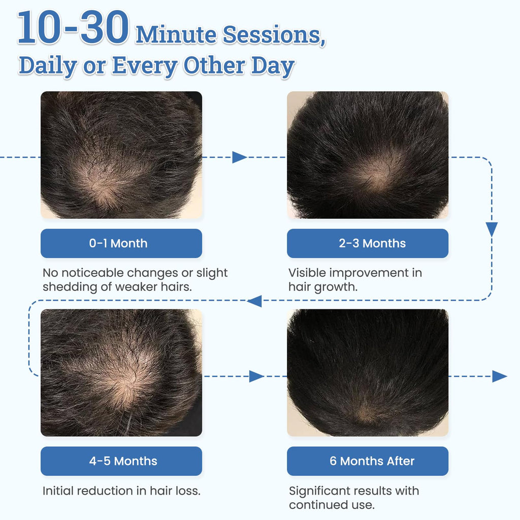 CWTUL TW316 Laser Hair Growth Cap – Home LLLT for Hair Support (Women & Men)