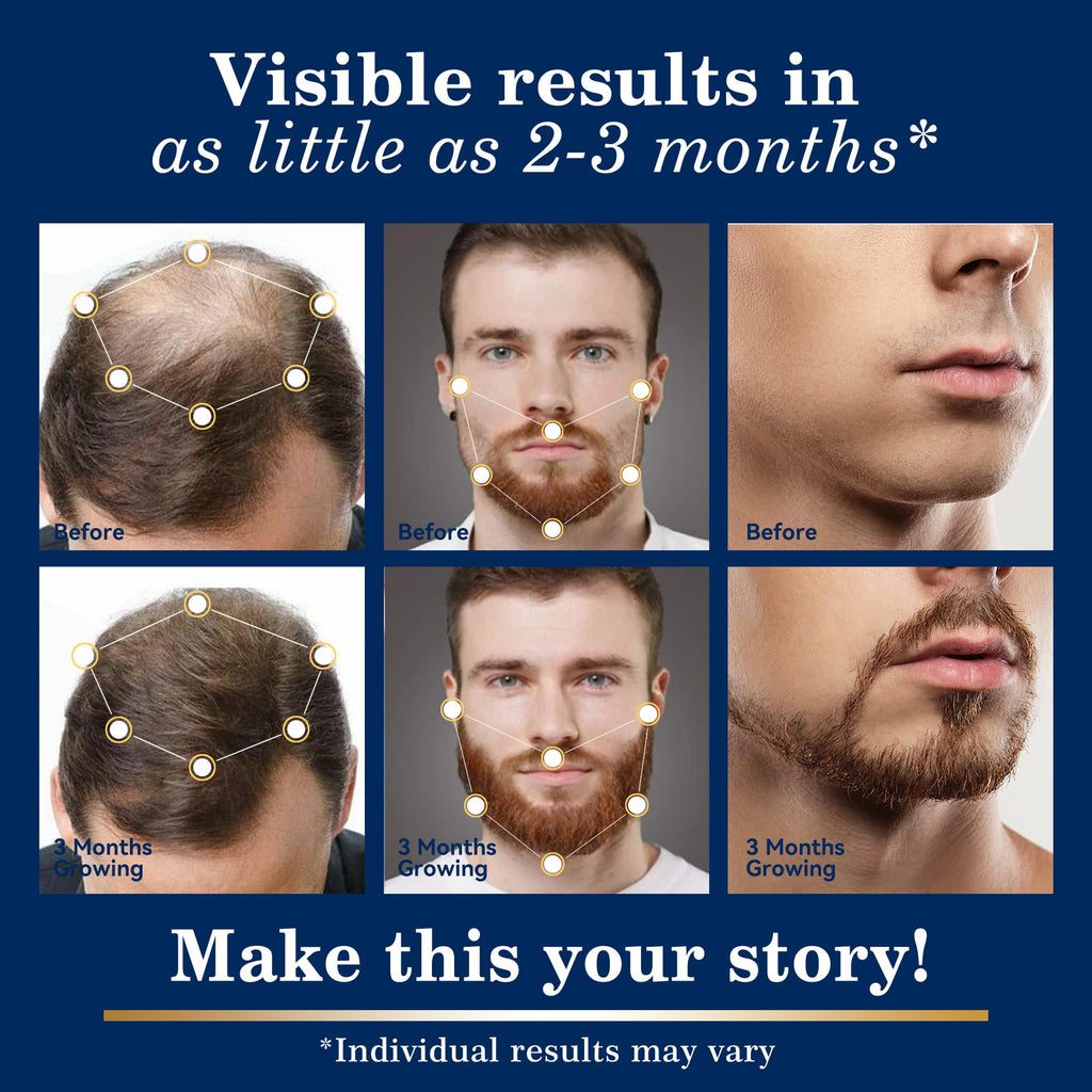 DAAZZS 5% Minoxidil Hair Growth Kit for Men & Women – Beard & Scalp Therapy, Biotin Included (2-Pack)