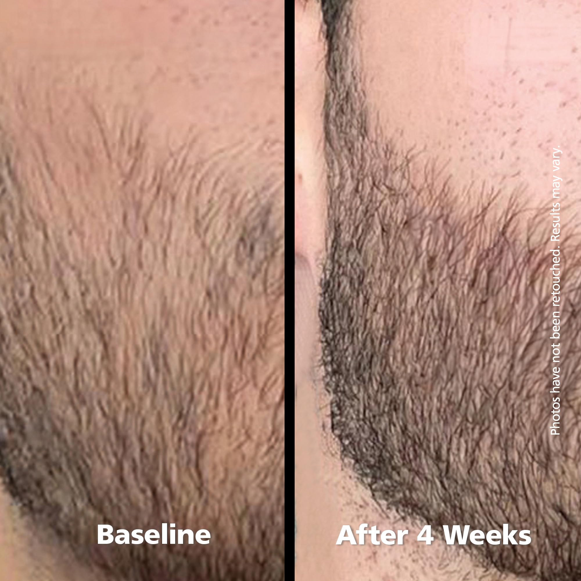 DABALASH Men Growth Serum for Facial Hair, Lashes & Brows – Castor Oil, 0.18 oz