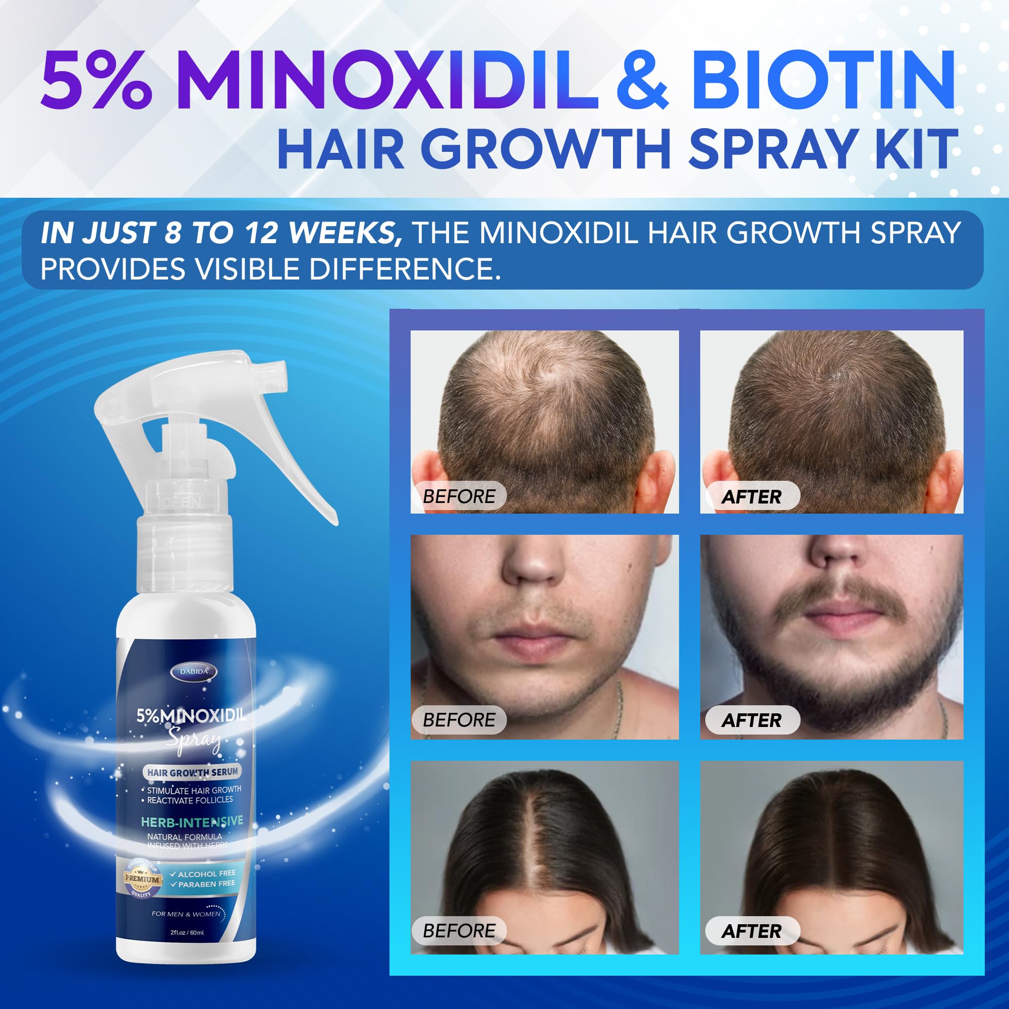 DABIDA 5% Minoxidil Spray for Men & Women – Hair Growth & Beard Growth, 3x60ml