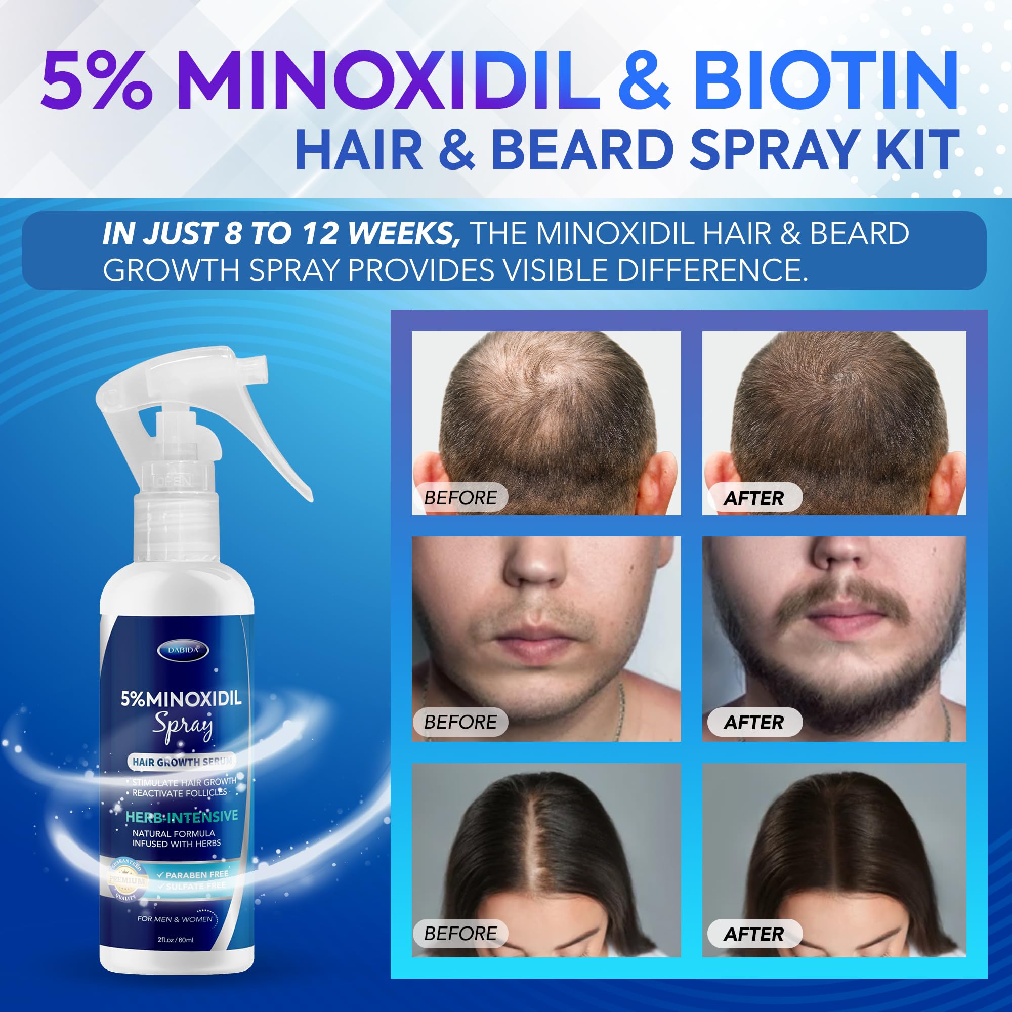 DABIDA 5% Minoxidil Hair Regrowth Spray – For Women & Men, 60ml