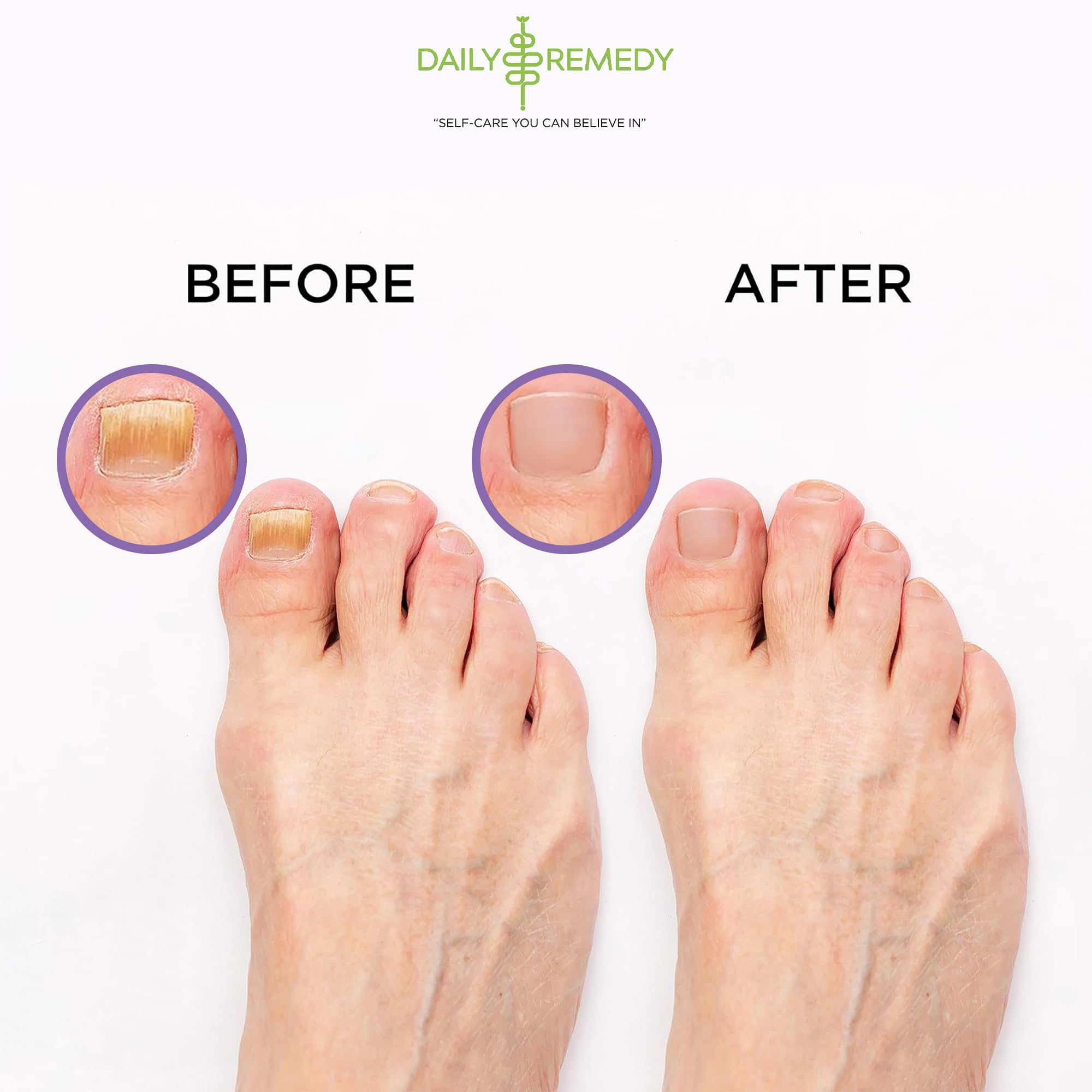 Daily Remedy Calming Lavender Foot Soak – Epsom Salt, Made in USA, Soothes Tired Feet, Softens Calluses, 16 oz