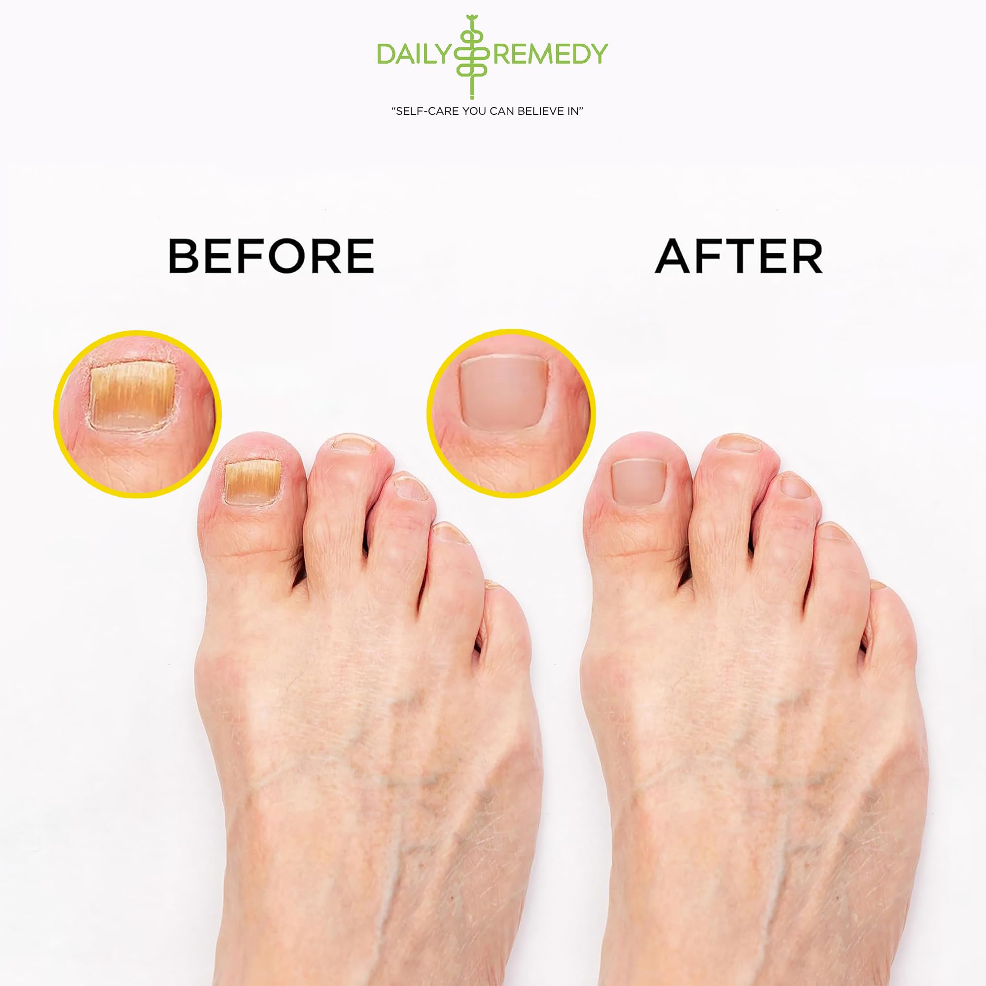 Daily Remedy Citrus Detox Foot Soak with Epsom Salt | Foot Care Pedicure | Made in USA