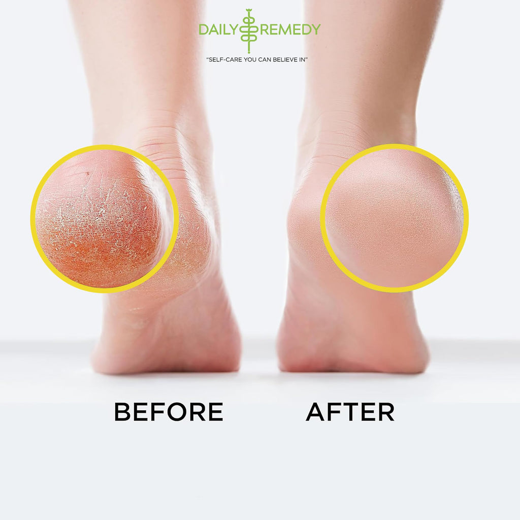 Daily Remedy Citrus Detox Foot Soak with Epsom Salt | Foot Care Pedicure | Made in USA