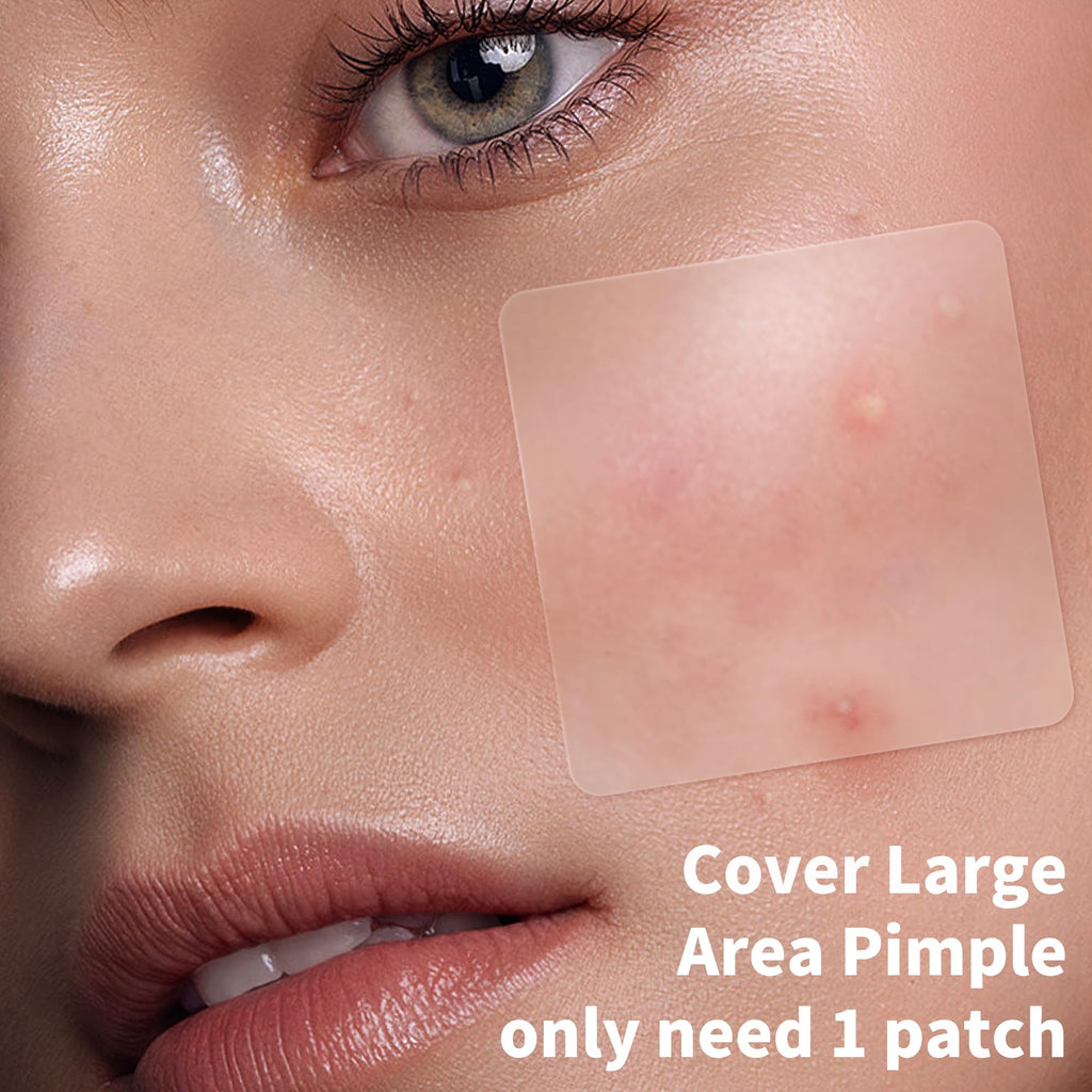 Daolyo Large Pimple Patches – 7 Sizes, 210 Patches for Face & Body