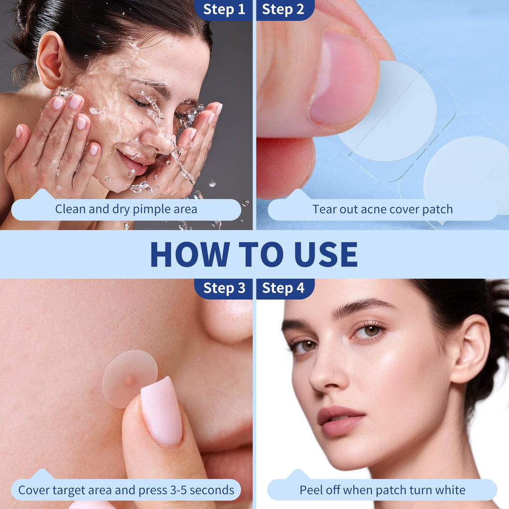 Daolyo Pimple Patches – 360 Hydrocolloid Acne Patches (4 Sizes) with Tea Tree, Calendula & Salicylic Acid