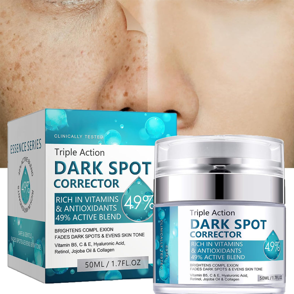 Dark Spot Cream for Face – Brighten and Even Skin Tone, 50 ml (1.7 fl oz)