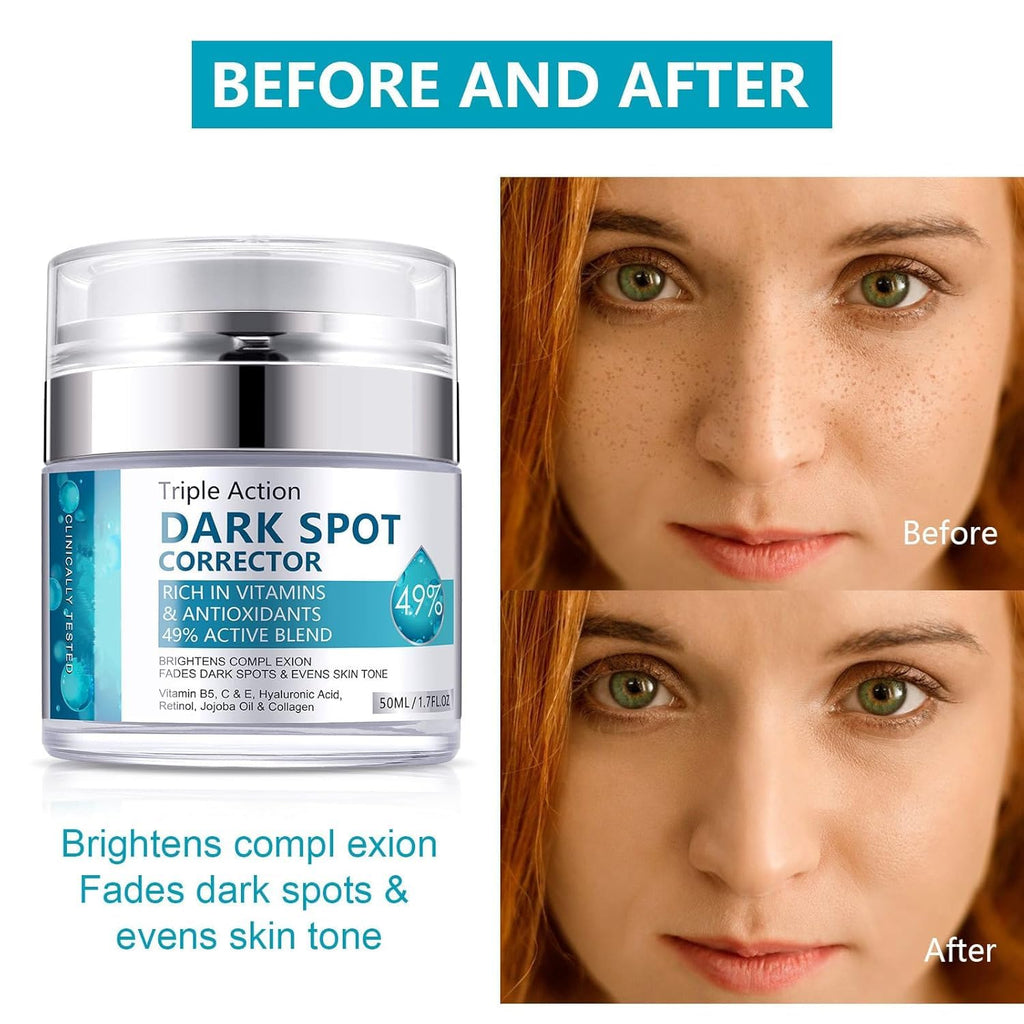 Dark Spot Cream for Face – Brighten and Even Skin Tone, 50 ml (1.7 fl oz)