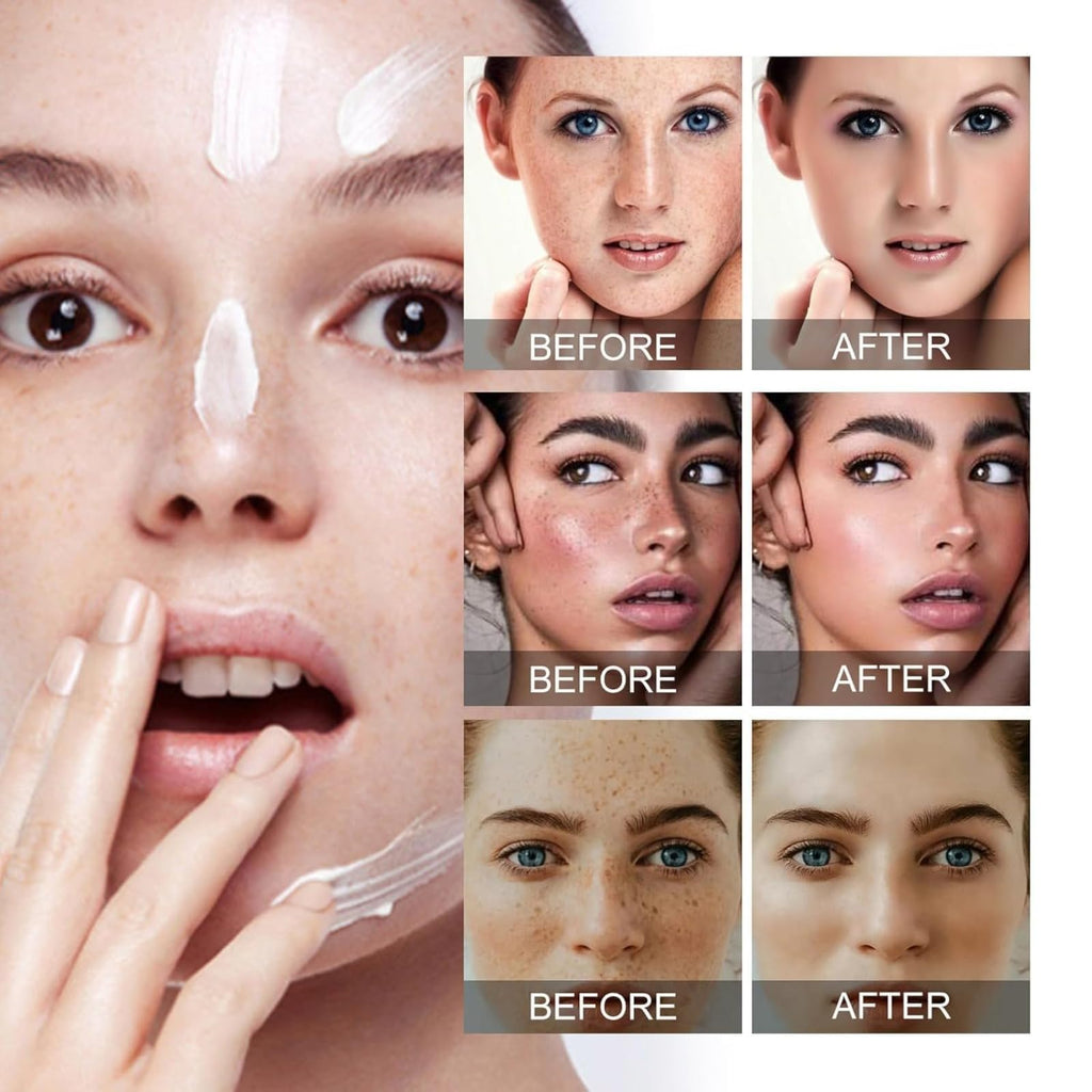 Dark Spot Cream for Face – Brighten and Even Skin Tone, 50 ml (1.7 fl oz)