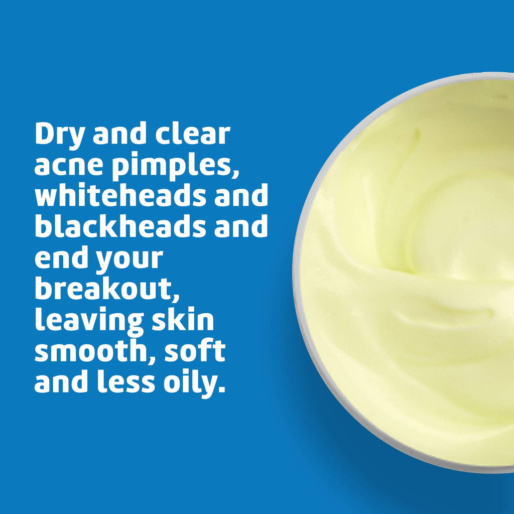 De La Cruz Sulfur Ointment - 5.5 oz | Cystic Acne Spot Treatment for Face & Body