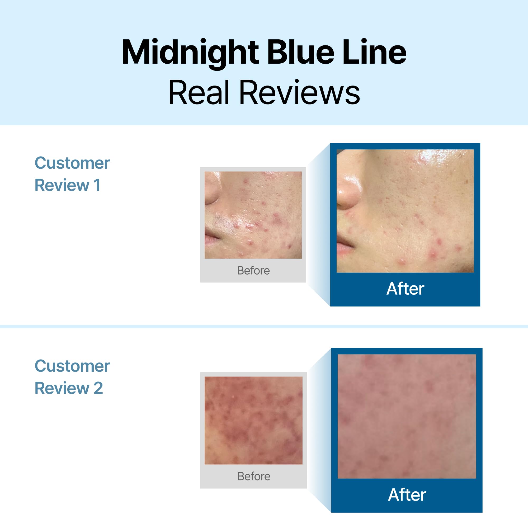 DearKlairs Midnight Blue Calming Cream – Lightweight Redness-Relieving Moisturizer for Oily & Sensitive Skin (1.05 Fl Oz)