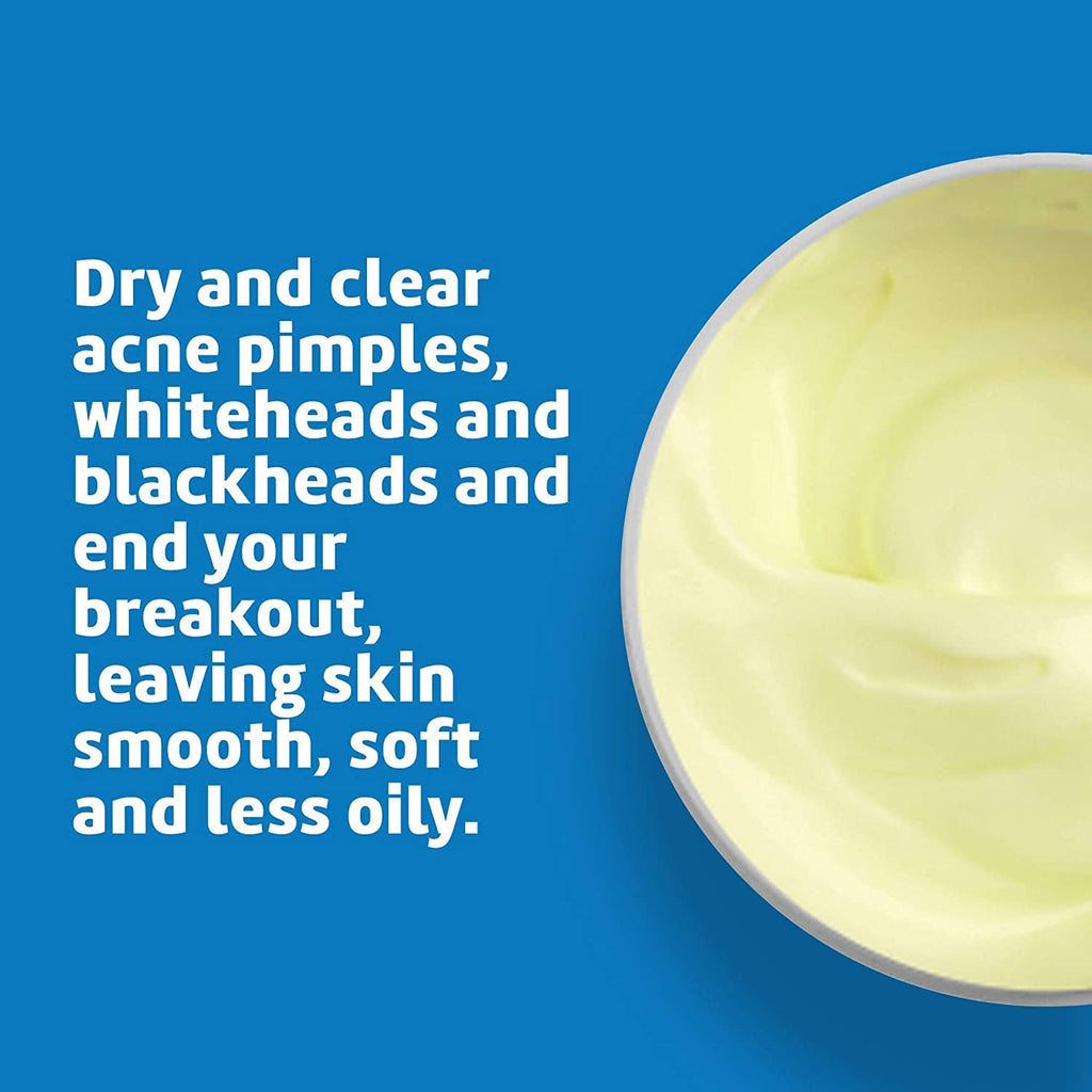 De La Cruz 10% Sulfur Ointment – Acne Spot Treatment for Face & Body, 2 x 2.6 oz