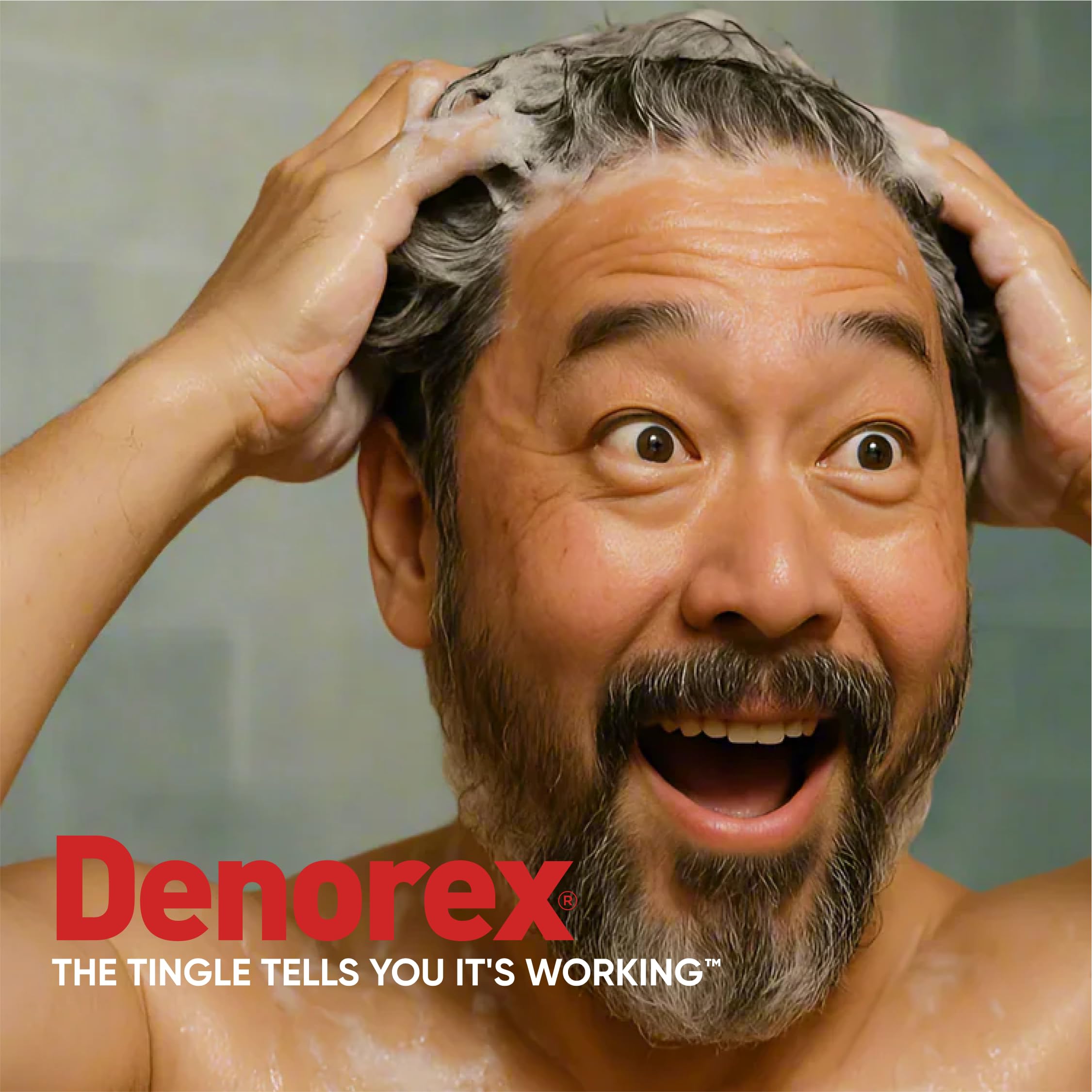Denorex Advanced Relief Severe Itch 2-in-1 Shampoo & Conditioner – 1.8% Coal Tar, 10 oz