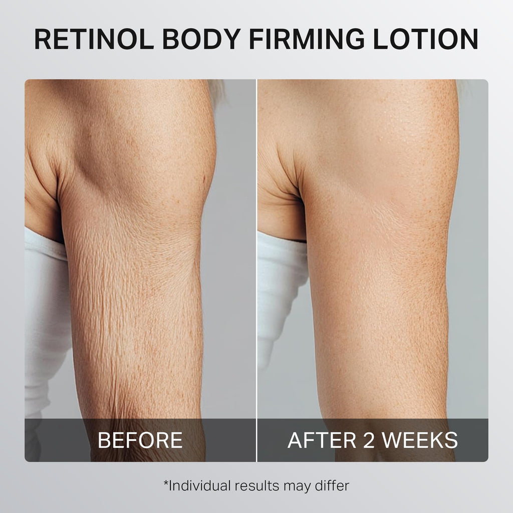 Depology Ultra-Size Firming Retinol Body Lotion for Crepey Skin & KP | 0.05% Retinol, AHA, Collagen, 10.14 fl oz