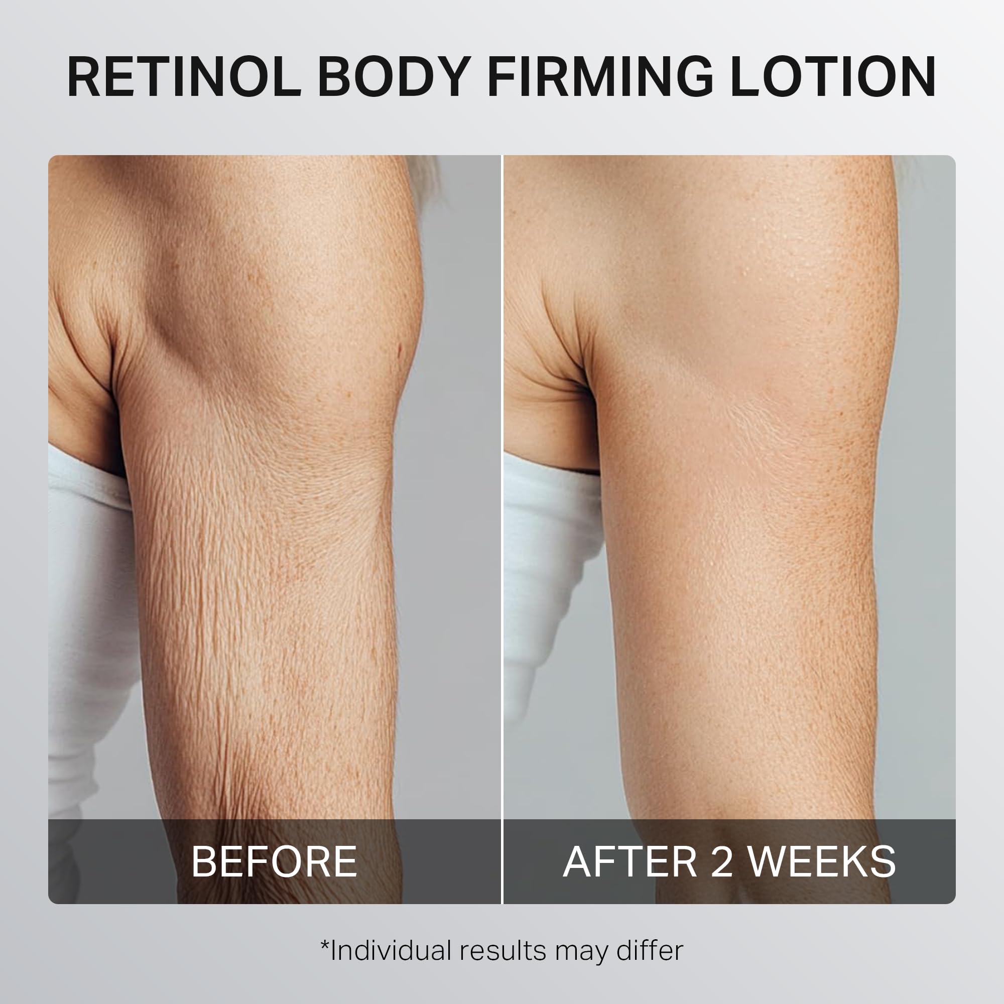 Depology Ultra-Size Firming Retinol Body Lotion for Crepey Skin & KP | 0.05% Retinol, AHA, Collagen, 10.14 fl oz
