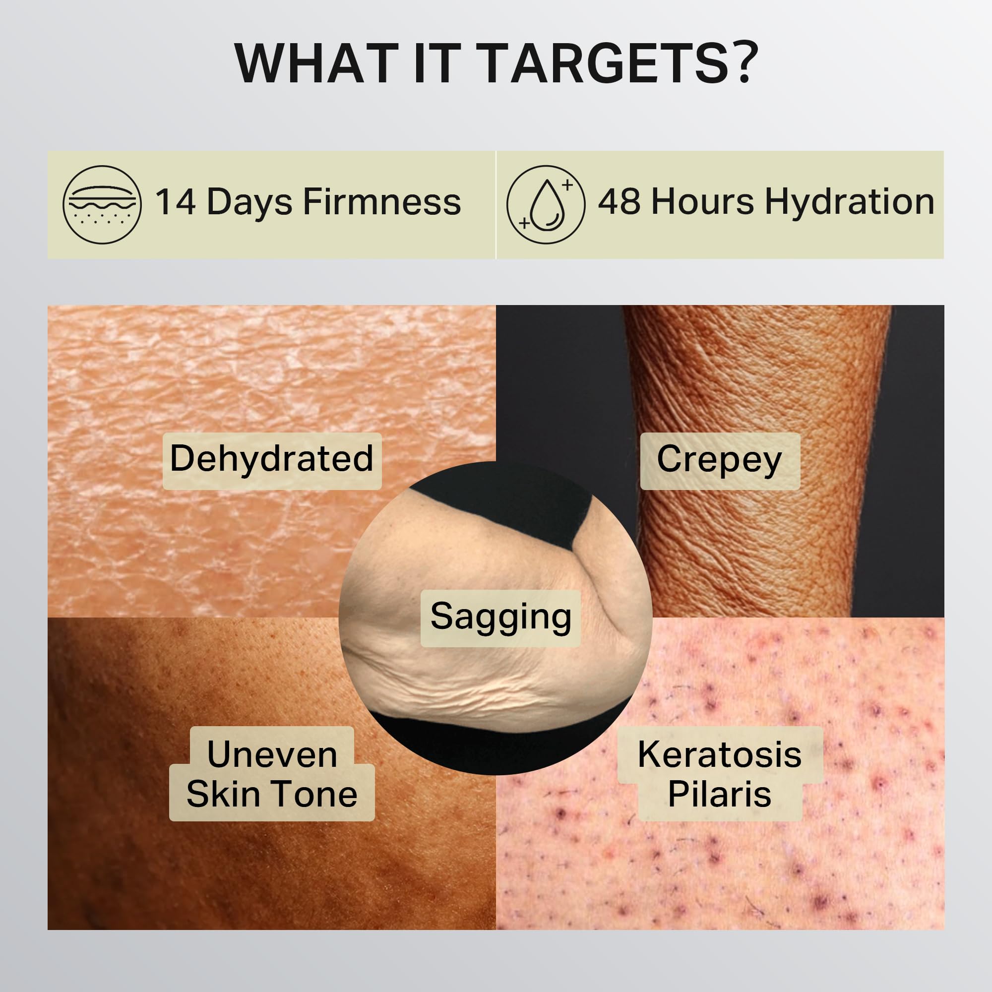 Depology Ultra-Size Firming Retinol Body Lotion for Crepey Skin & KP | 0.05% Retinol, AHA, Collagen, 10.14 fl oz
