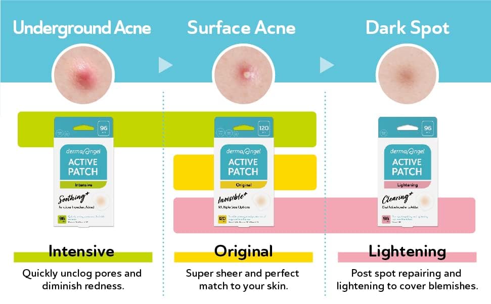 DERMA ANGEL Dark Spot Patches – 96 Count | Hydrocolloid Acne Patches with TXA & CICA for Active Acne & Post-Inflammation