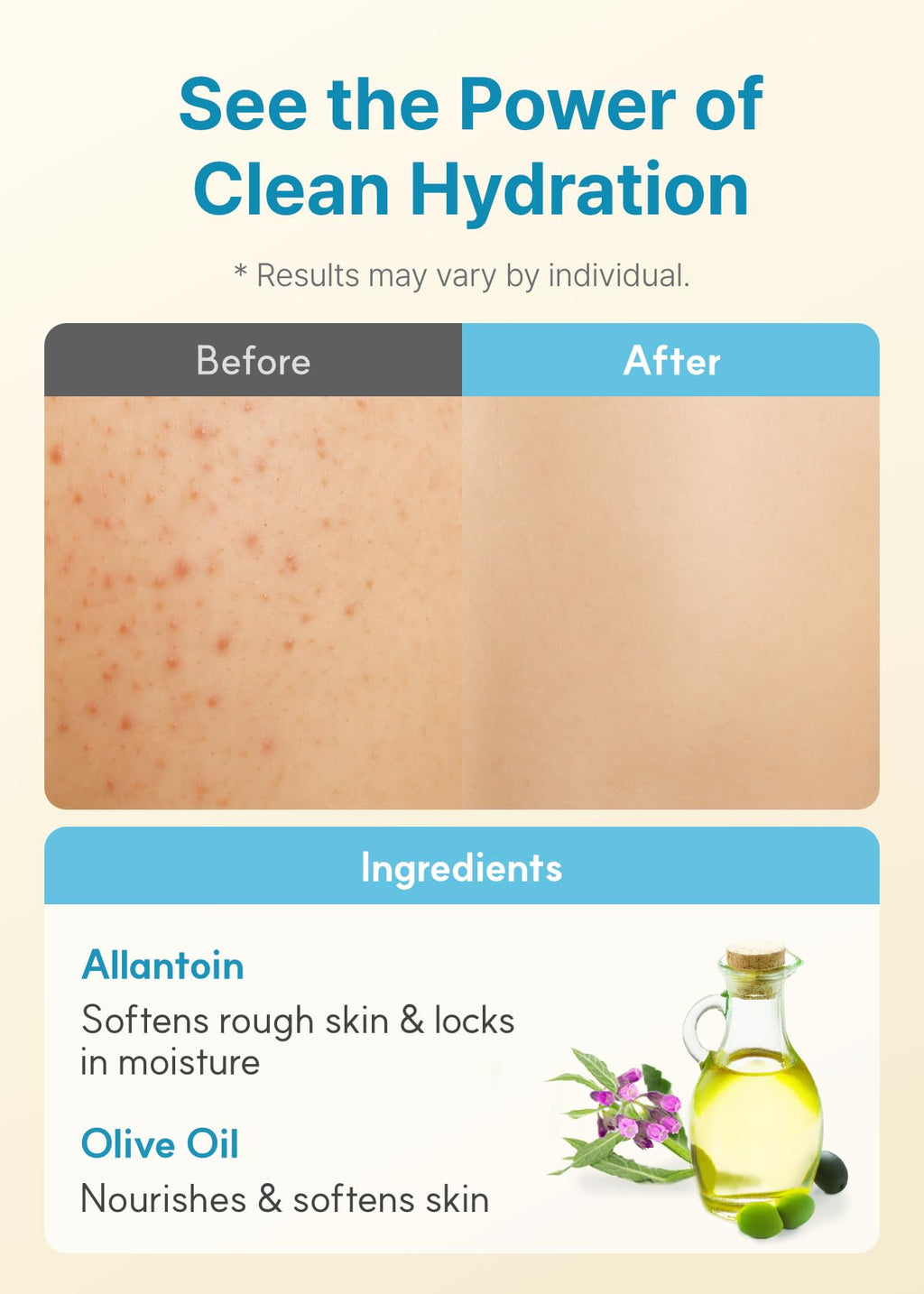 Derma B Daily Moisture Body Lotion - Long-Lasting Hydration for Sensitive Skin | 13.5 oz