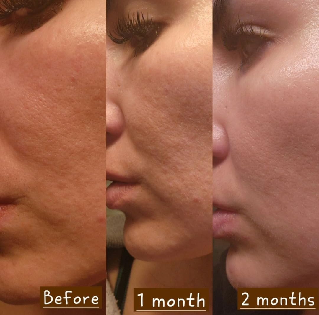 Derma Detox Rejuvenating Night Cream with Retinol, Tepezcohuite & Niacinamide