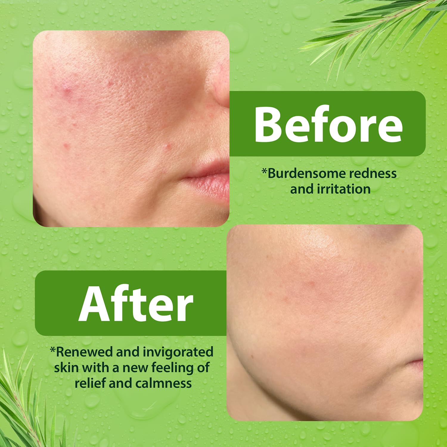 Derma-Nu Gentle Face Wash – Hydrating Cleanser for Sensitive & Oily Skin