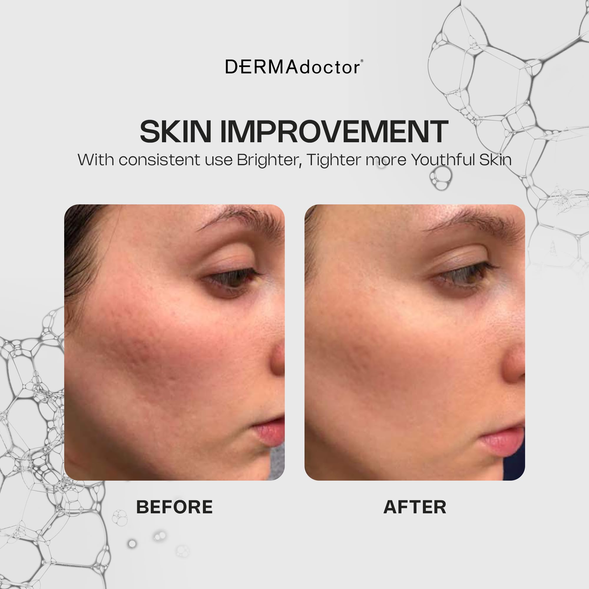 DERMAdoctor Vitamin C Serum 20% with Vitamin E & Ferulic Acid — Brightening, Hydrating Anti-Aging Serum | 1 oz