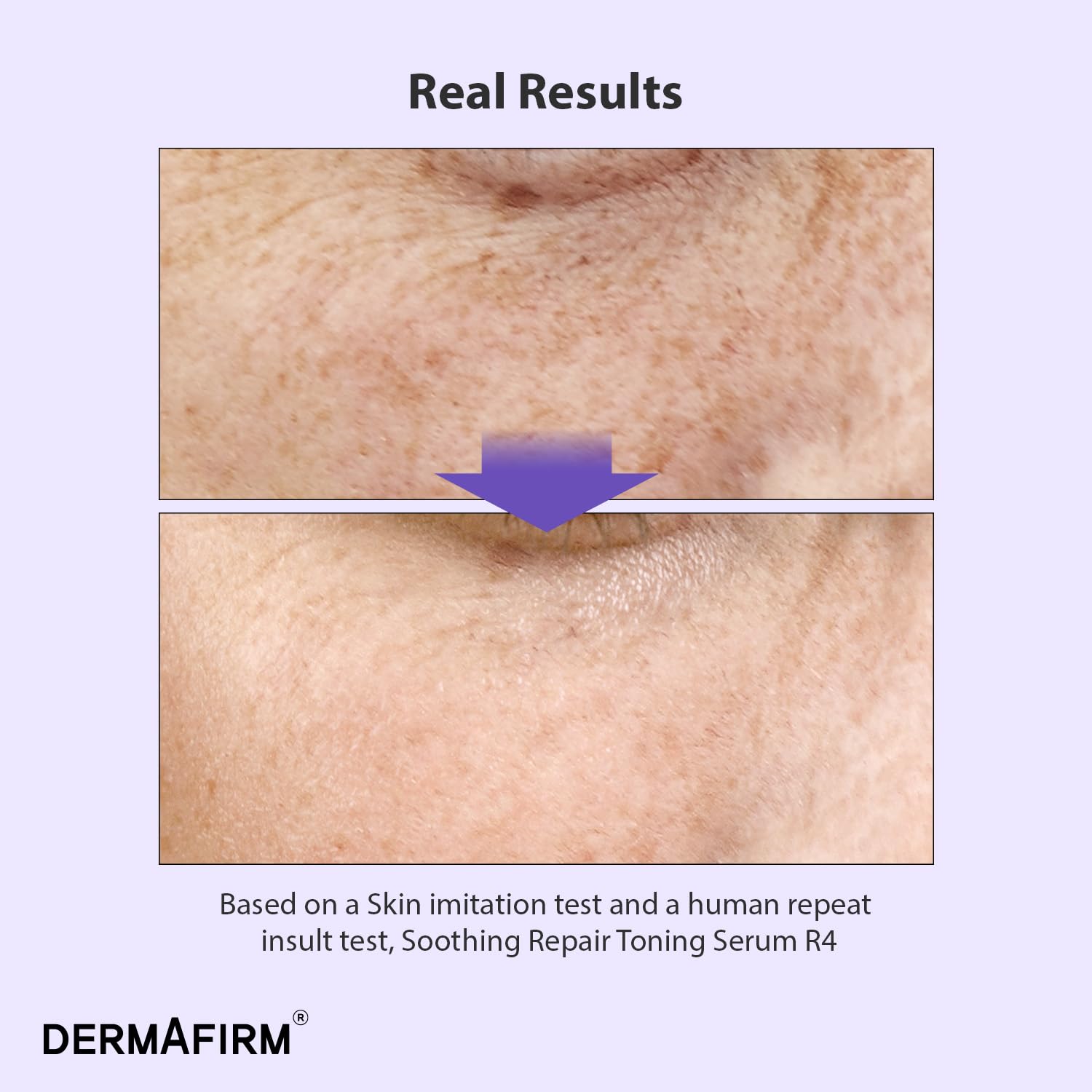 DERMAFIRM Bakuchiol Retinol Serum with Niacinamide & Peptides – Glass Skin R4