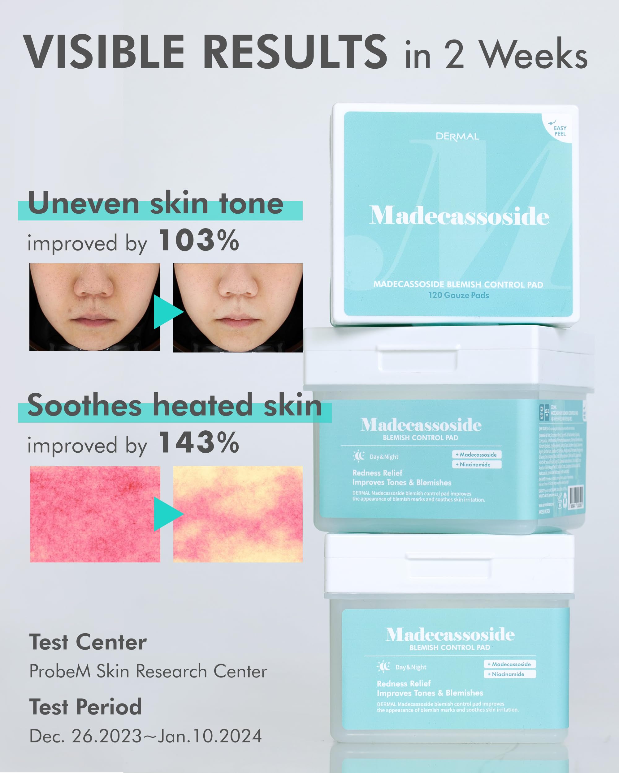 DERMAL Madecassoside Blemish Control Pad – 120-Sheet Korean Toner Pad with Centella Asiatica, Gauze Tencel