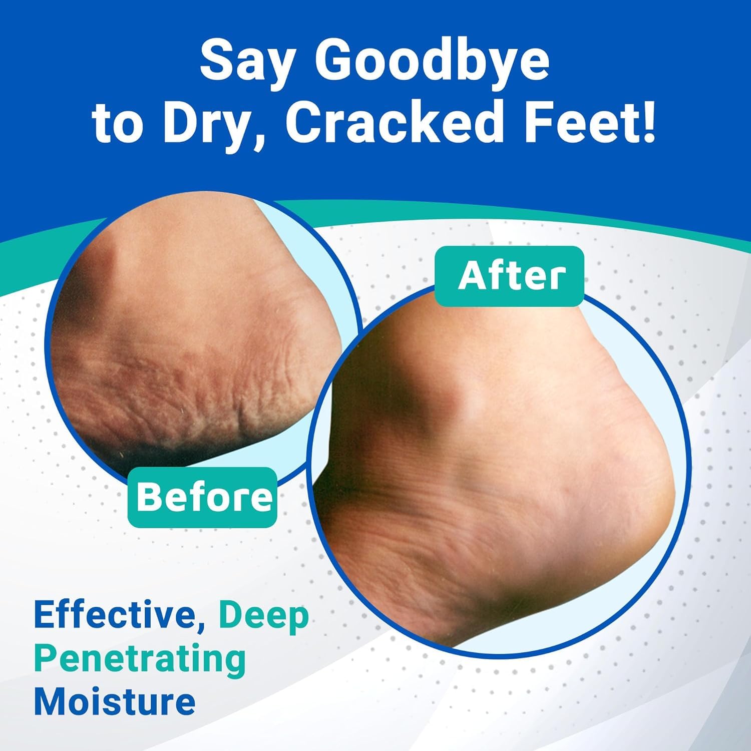 Dermal Therapy Heel Care Cream – 25% Urea + 6% AHAs | Deep Moisturizing Foot Repair (3oz & 8oz Bundle)