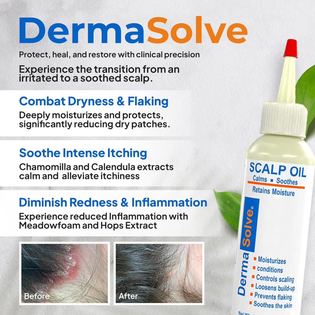Dermasolve Psoriasis & Dandruff Oil – Dermatologist-Approved Scalp Relief