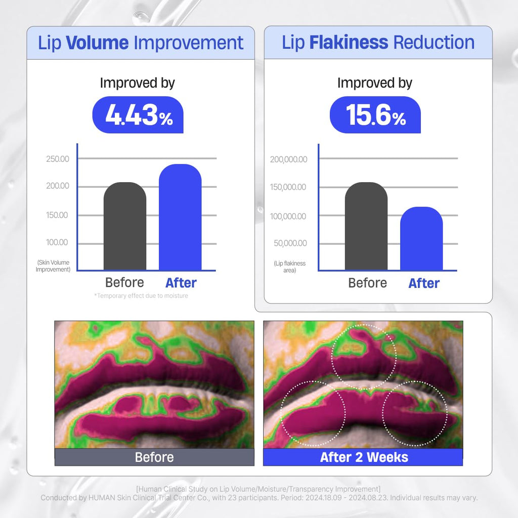 DERMATORY Hyalluron Peptide Volume Lip Mask Balm – Hydrating Lip Mask for Day & Night (10ml)