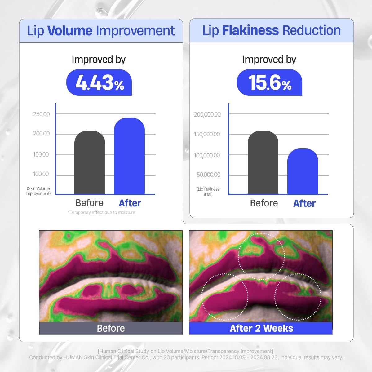 DERMATORY Hyalluron Peptide Volume Lip Mask Balm – Hydrating Lip Mask for Day & Night (10ml)