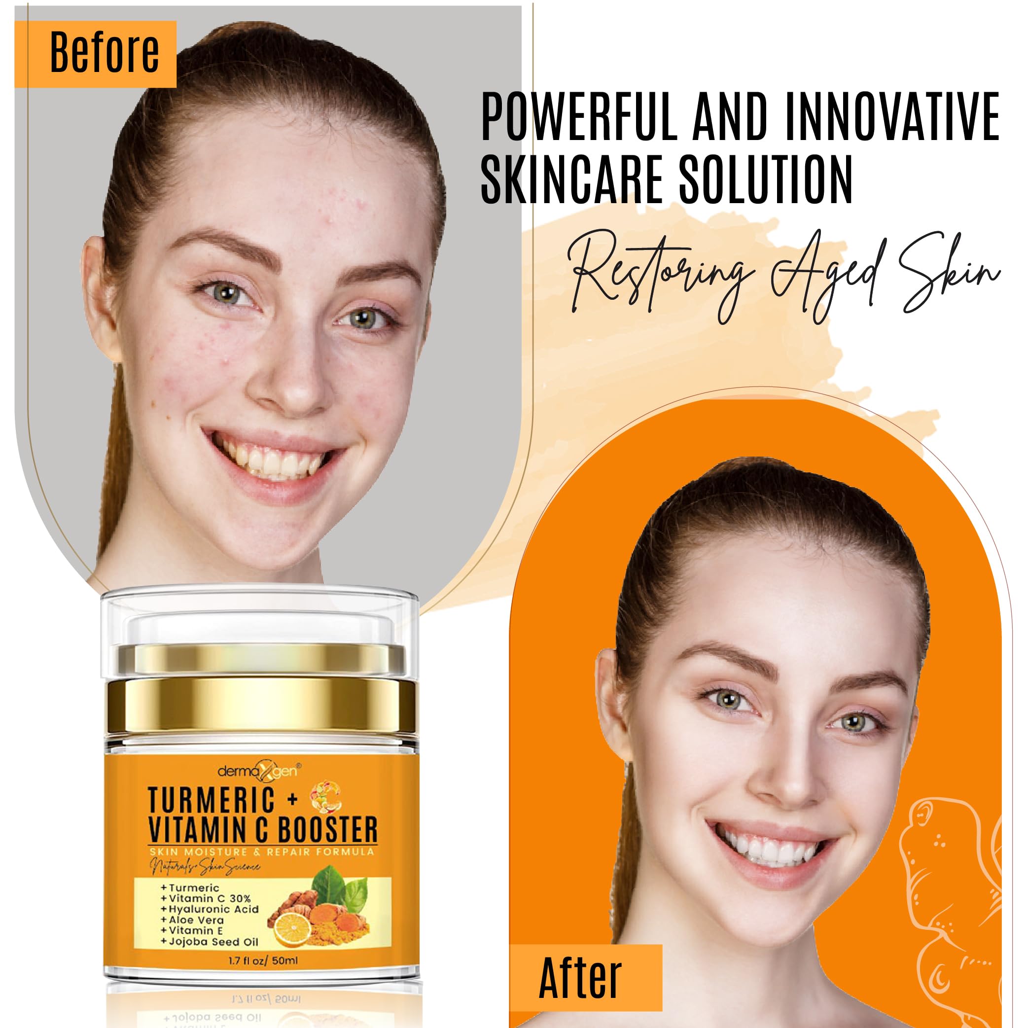 Dermaxgen Turmeric Vitamin C Cream – Glow Boost, Anti-Aging & Hydration for All Skin Types (1.7 oz)