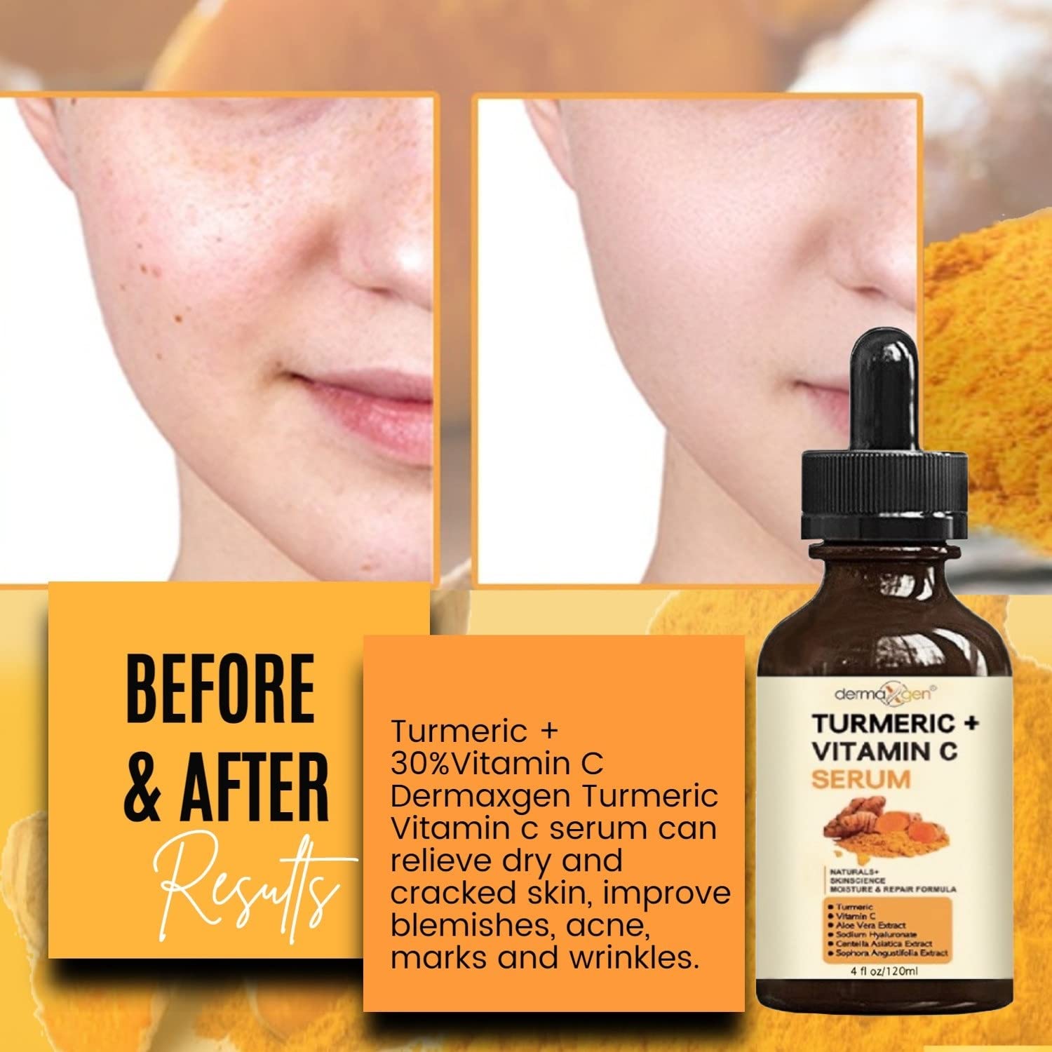 DERMAXGEN Turmeric Serum + Vitamin C — Glow-Boosting Organic Moisturizer (4 oz)