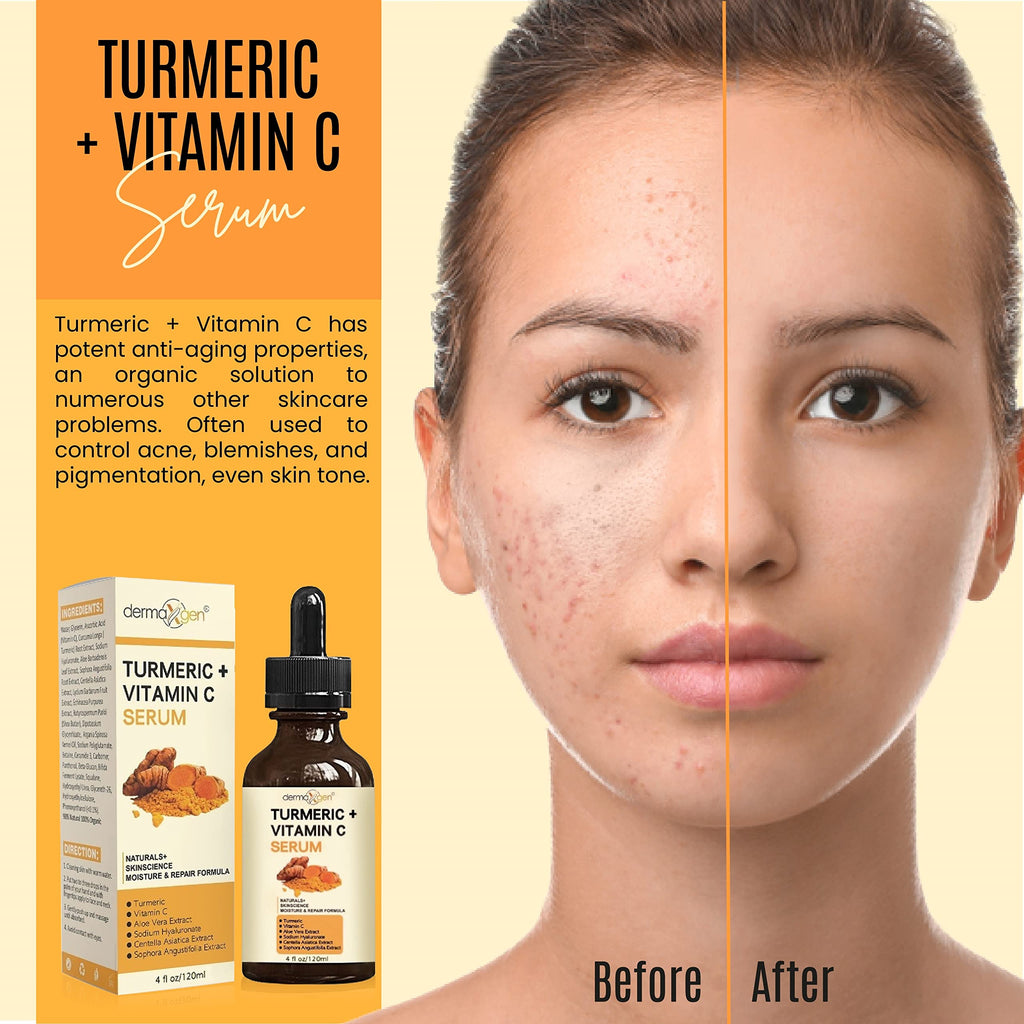 DERMAXGEN Turmeric Serum + Vitamin C — Glow-Boosting Organic Moisturizer (4 oz)