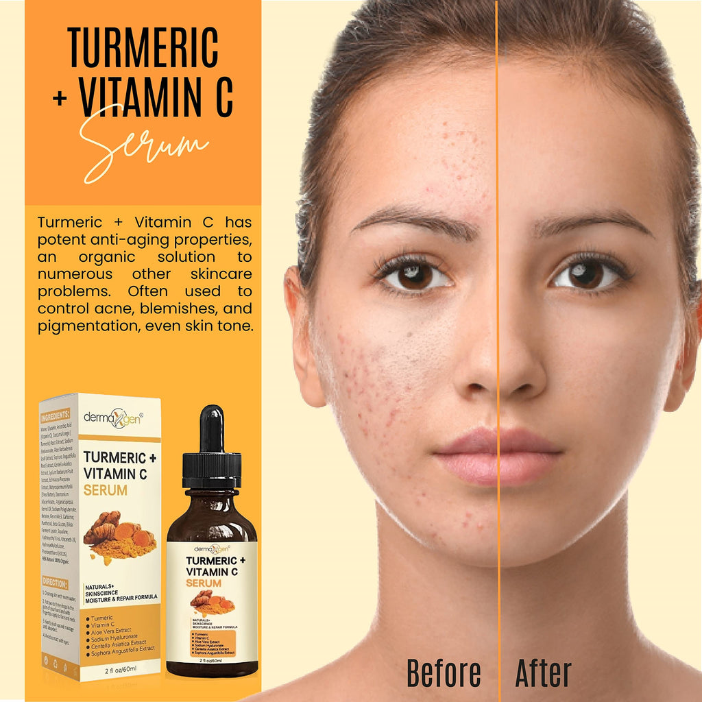 DERMAXGEN Turmeric Serum + Vitamin C – Glow-Boosting Organic Moisturizer (2 fl oz)