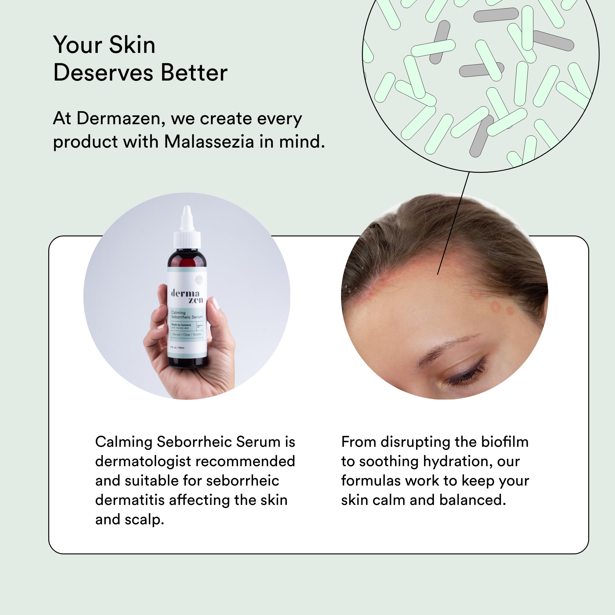 Dermazen Calming Seborrheic Serum – Dermatologist Recommended Topical Serum for Hair, Face & Body (4oz)