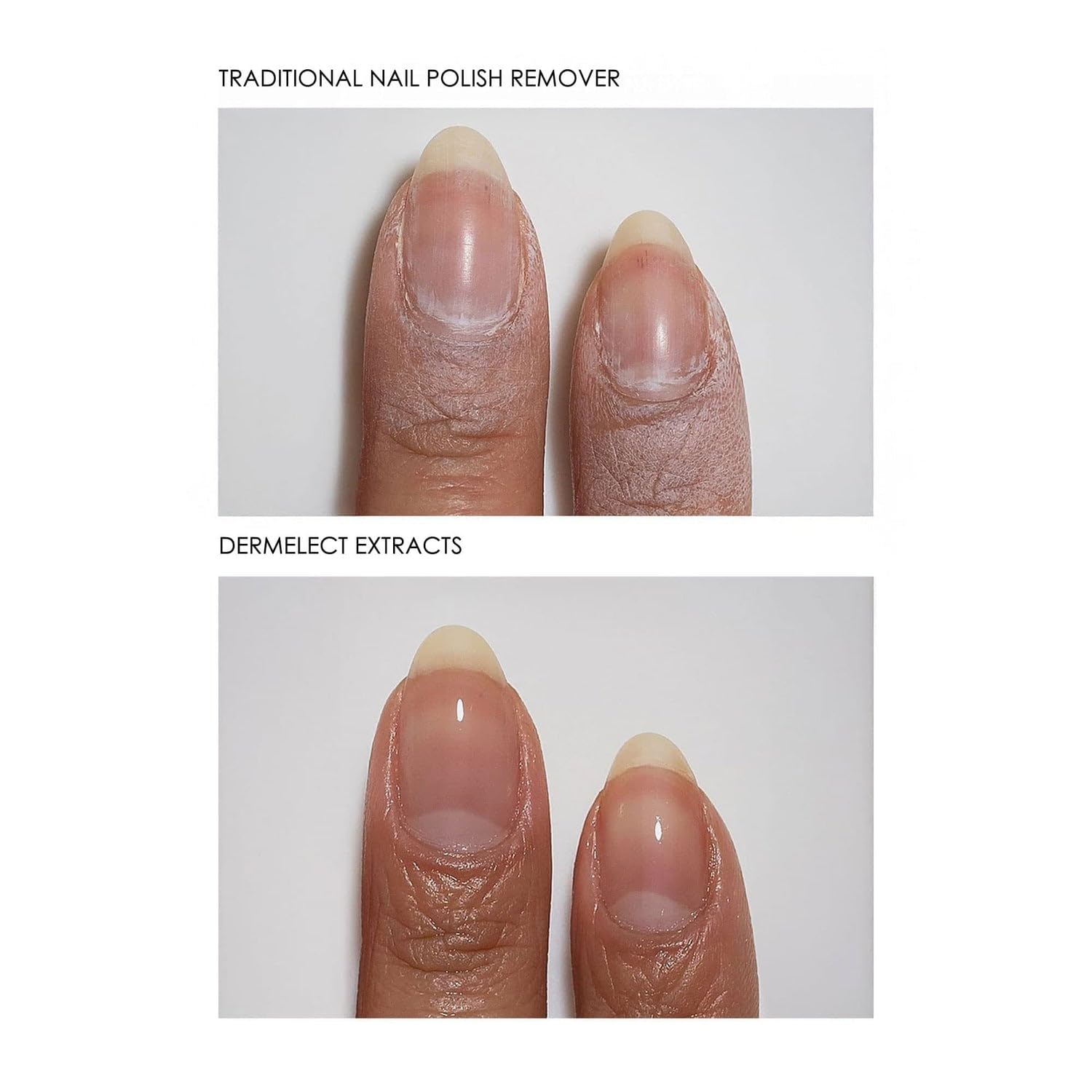 Dermelect Extracts 3-in-1 Soy Nail Polish Remover Wipes – Scentless, Acetone-Free (10 Pack)