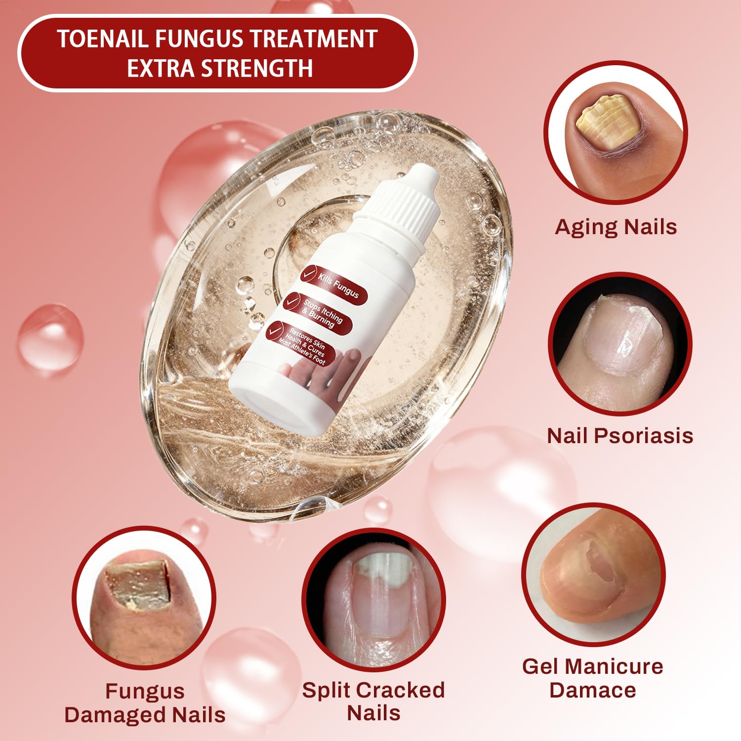 DERMFREE Fungi Nail Treatment Extra Strength for Thick and Discolored Nails | Toenail Renewal Serum