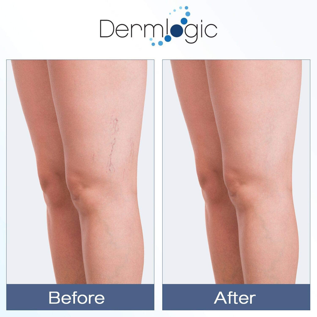 Dermlogic Vitamin K Cream – Moisturizing Bruise Healing & Dark Spot Corrector
