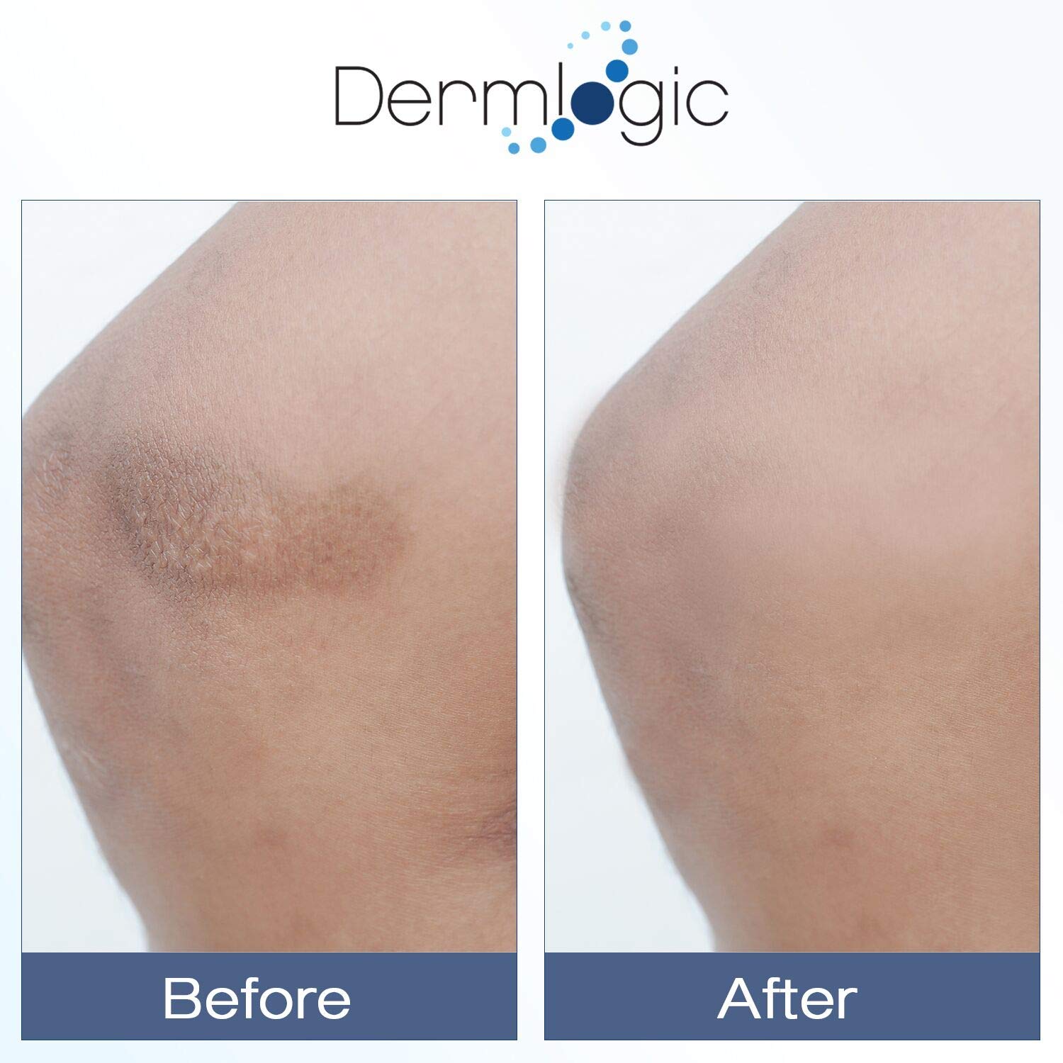 Dermlogic Vitamin K Cream – Moisturizing Bruise Healing & Dark Spot Corrector